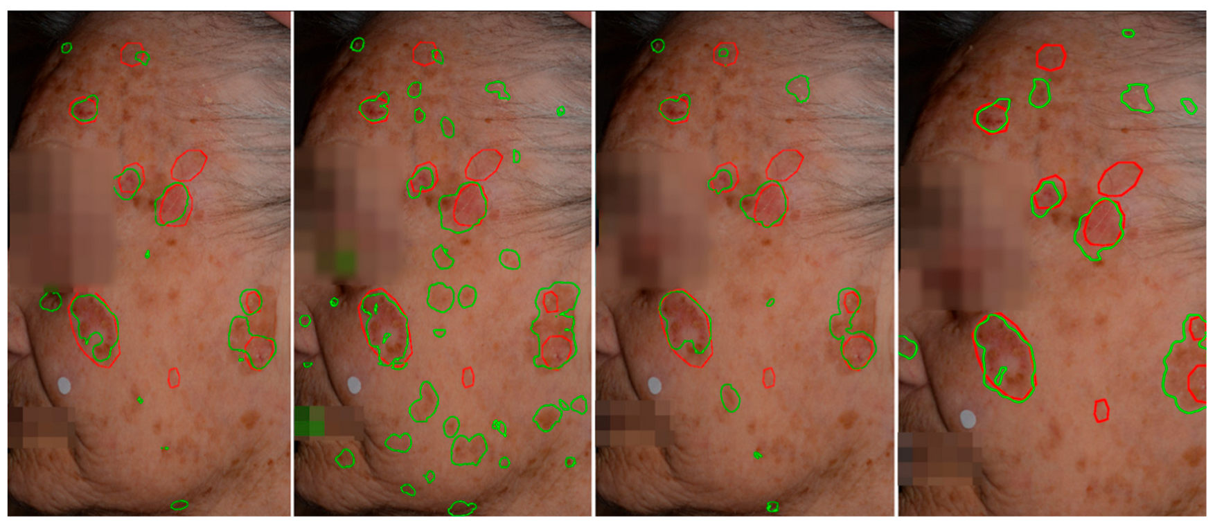Diagnostics 15 01752 g007