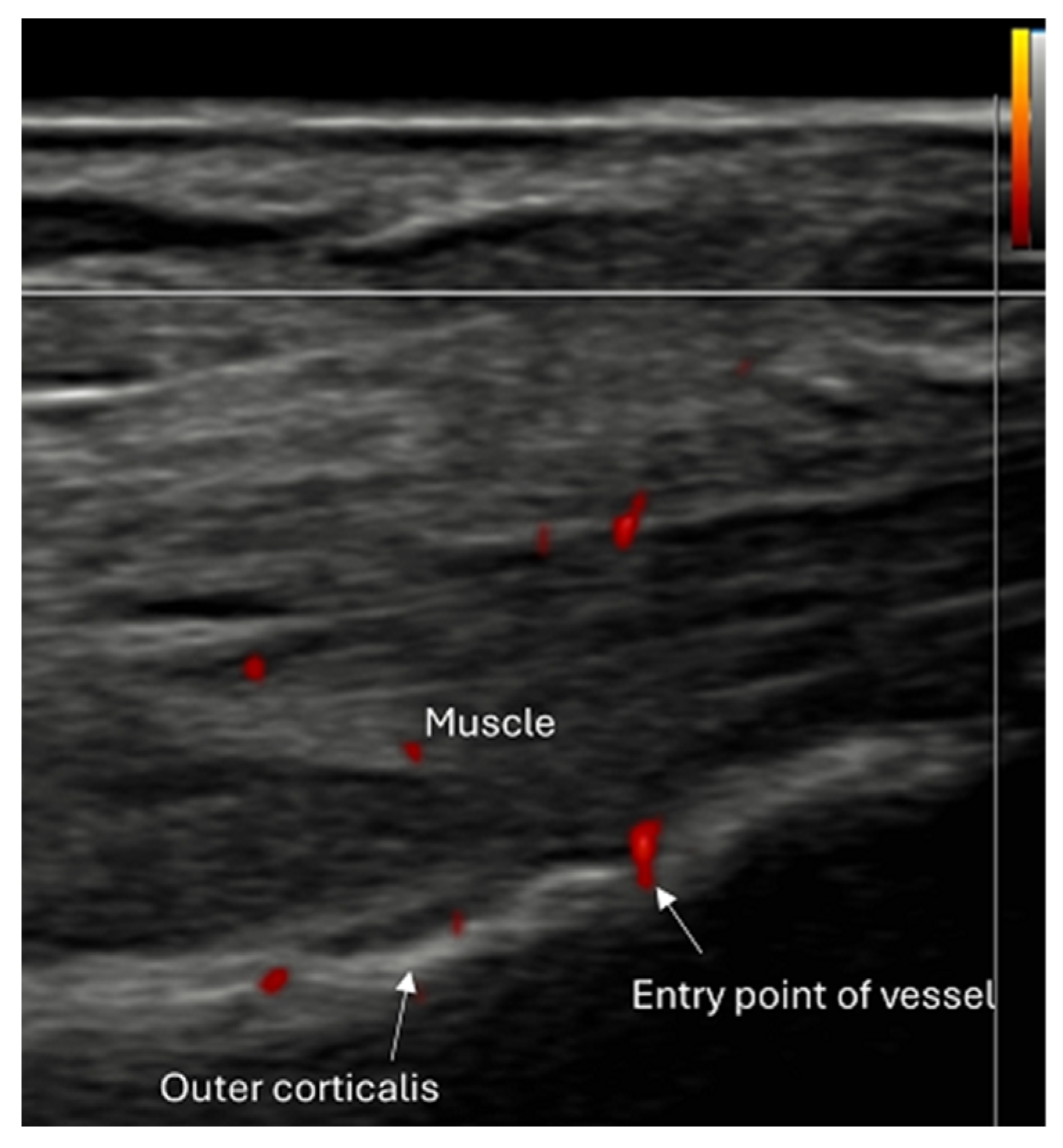 Diagnostics 15 01827 g002 Diagnostics 15 01827 g002