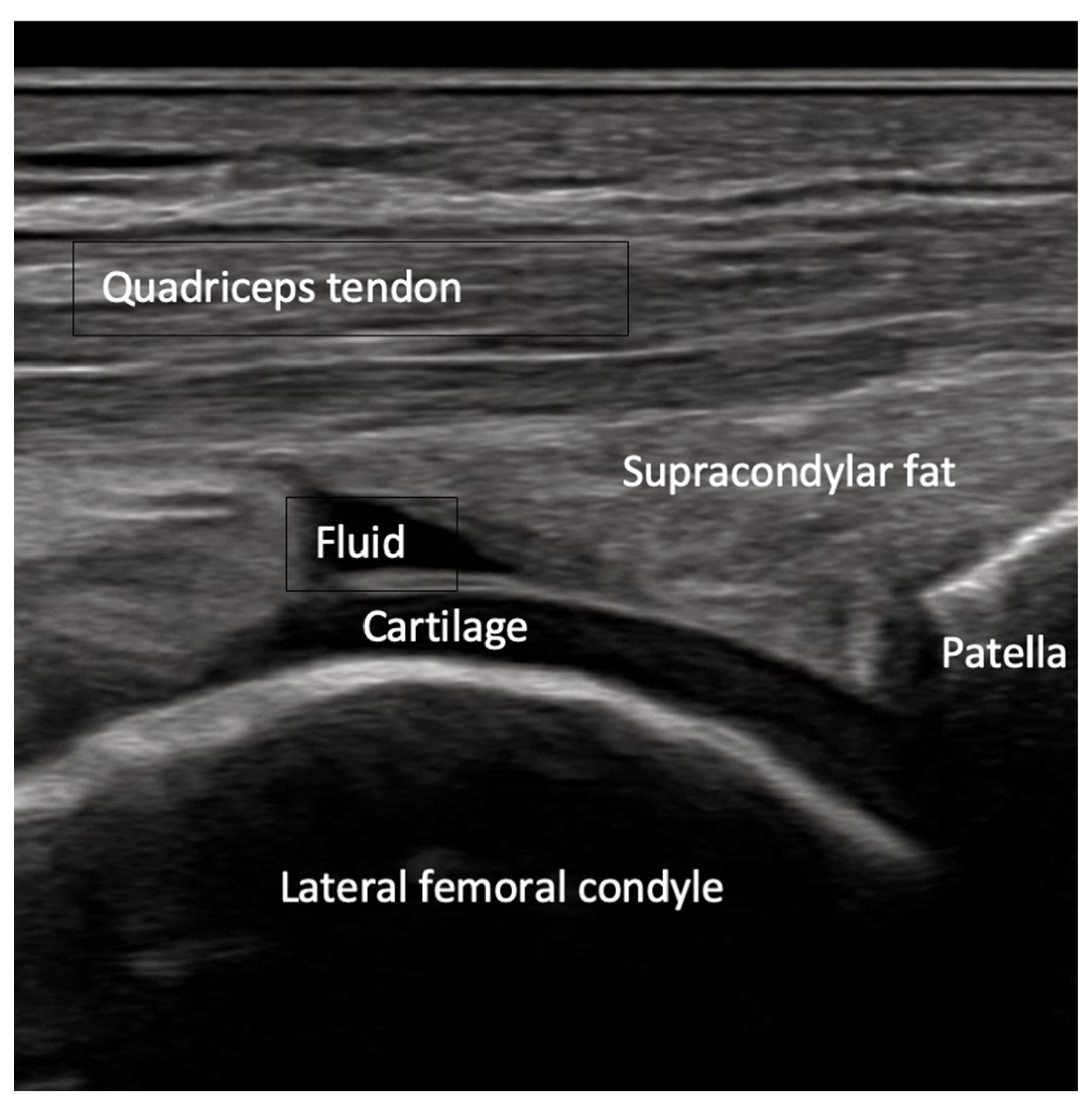 Diagnostics 15 01827 g004 Diagnostics 15 01827 g004