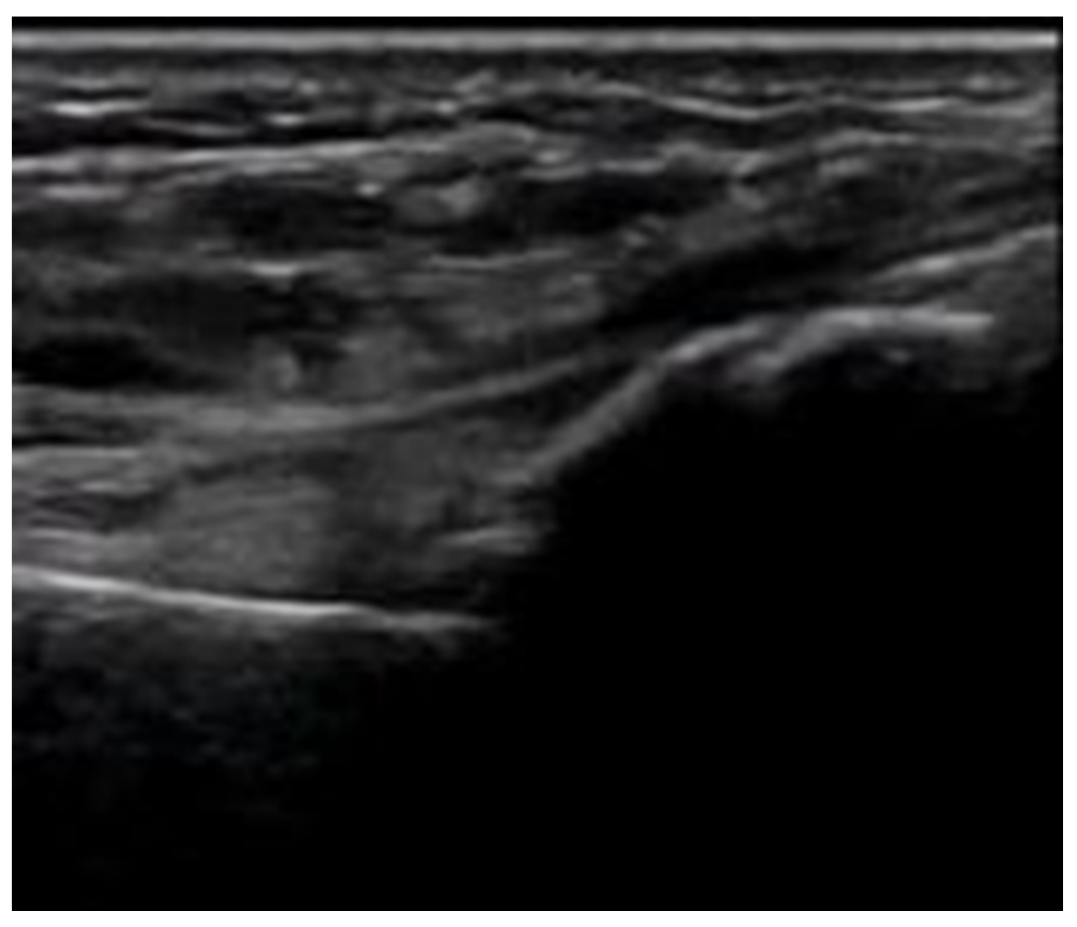 Diagnostics 15 01827 g008 Diagnostics 15 01827 g008