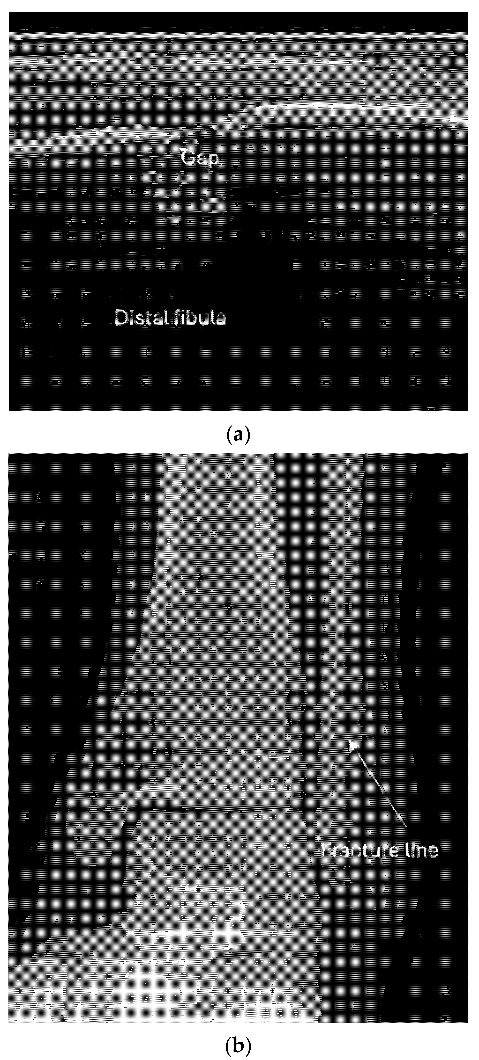 Diagnostics 15 01827 g009 Diagnostics 15 01827 g009