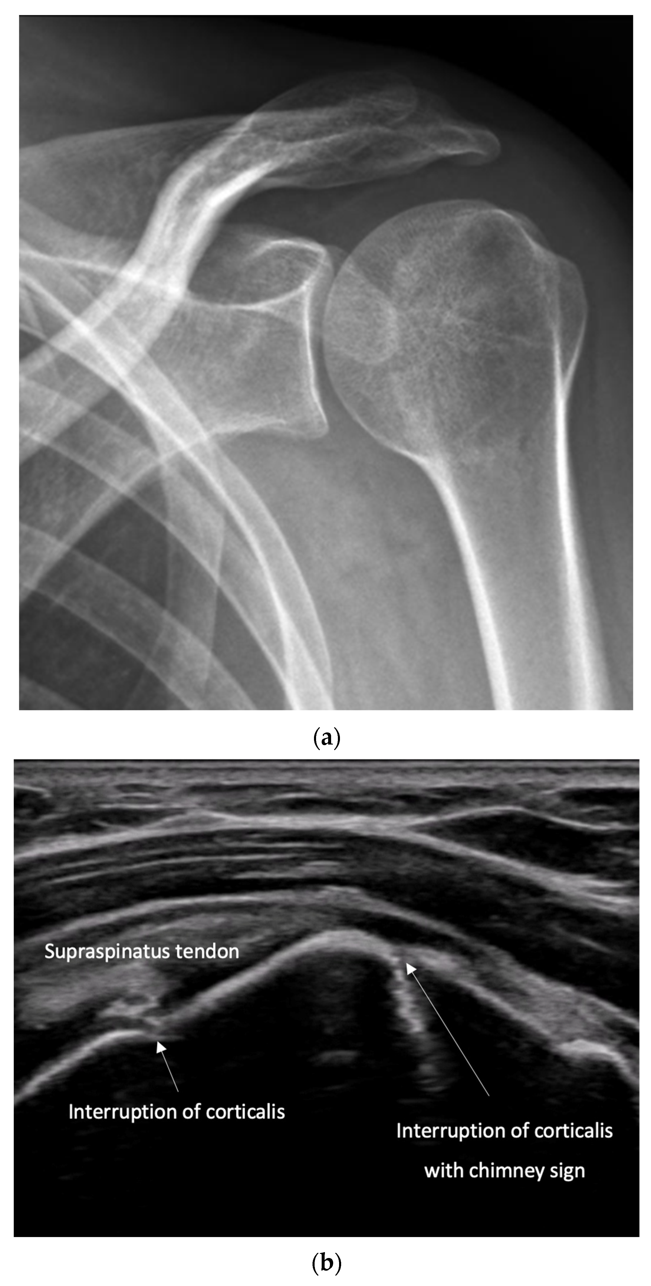 Diagnostics 15 01827 g010 Diagnostics 15 01827 g010