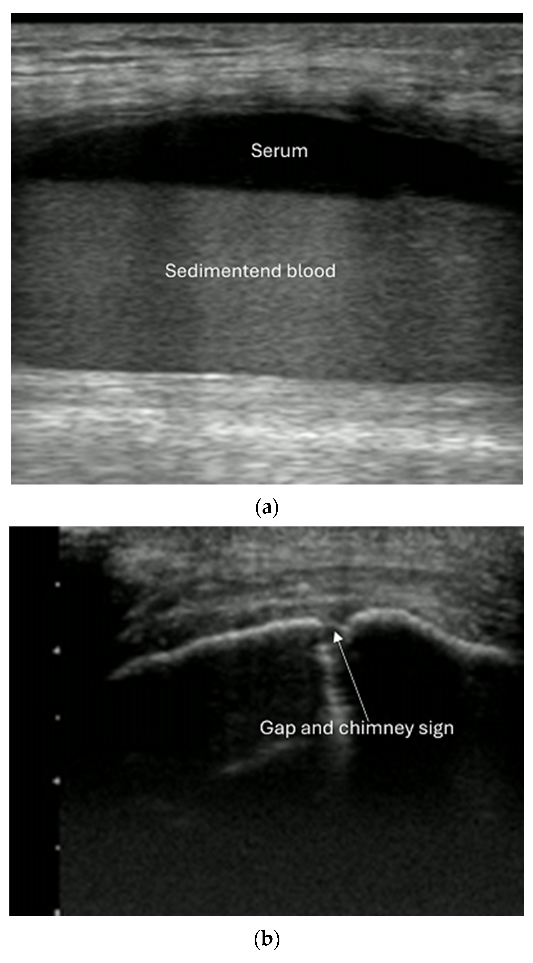 Diagnostics 15 01827 g011 Diagnostics 15 01827 g011