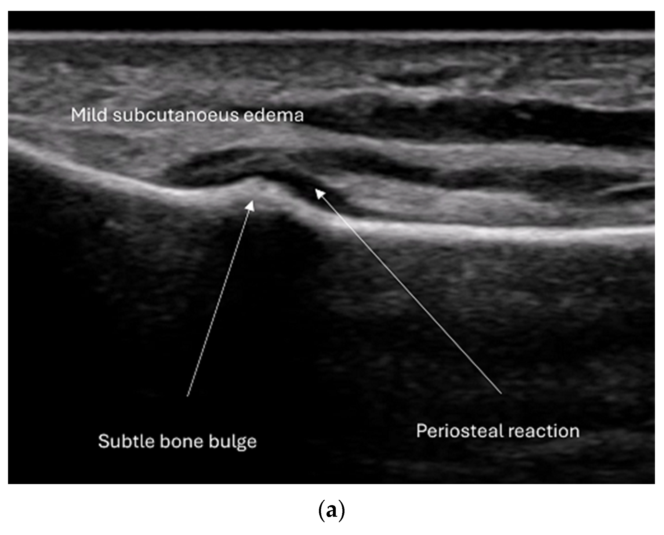 Diagnostics 15 01827 g012a Diagnostics 15 01827 g012a