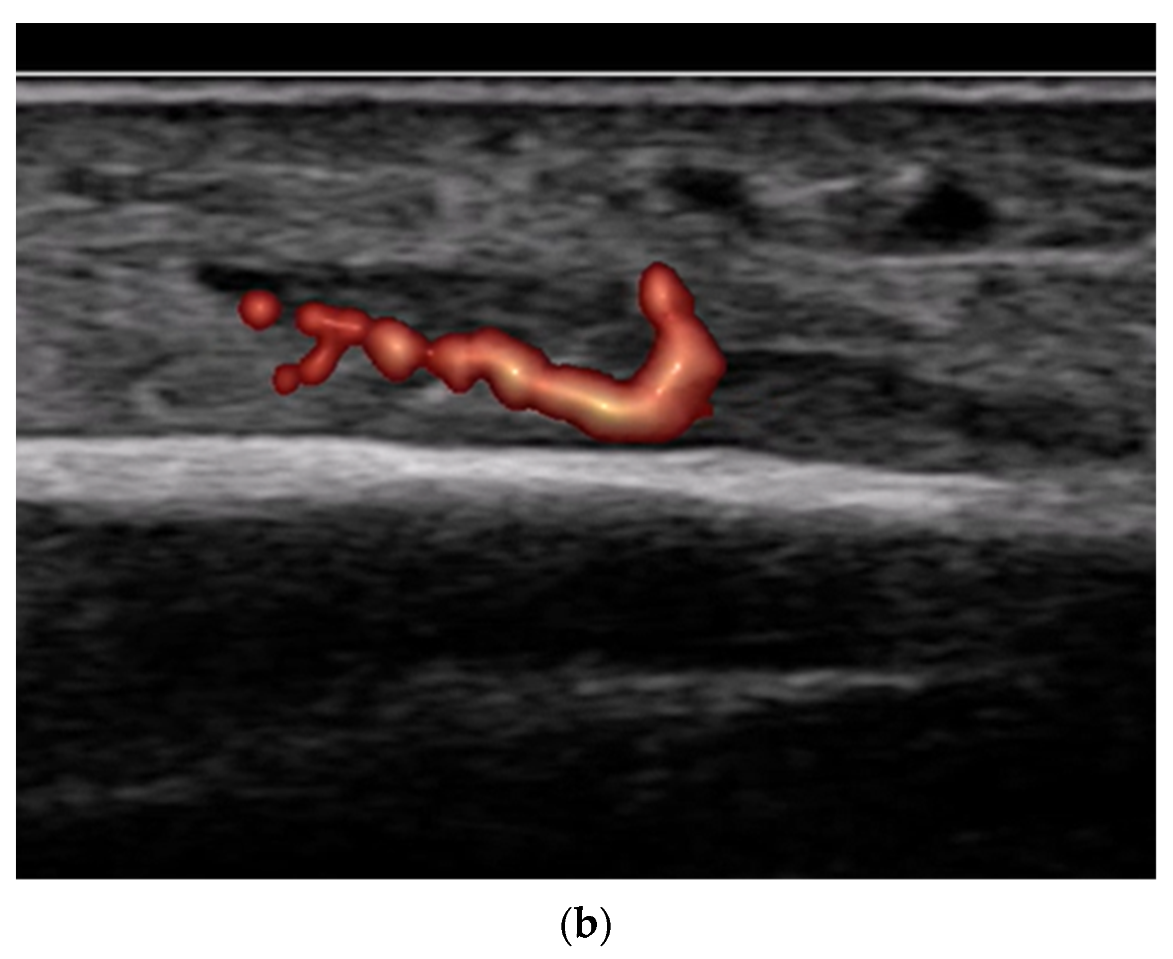 Diagnostics 15 01827 g012b Diagnostics 15 01827 g012b