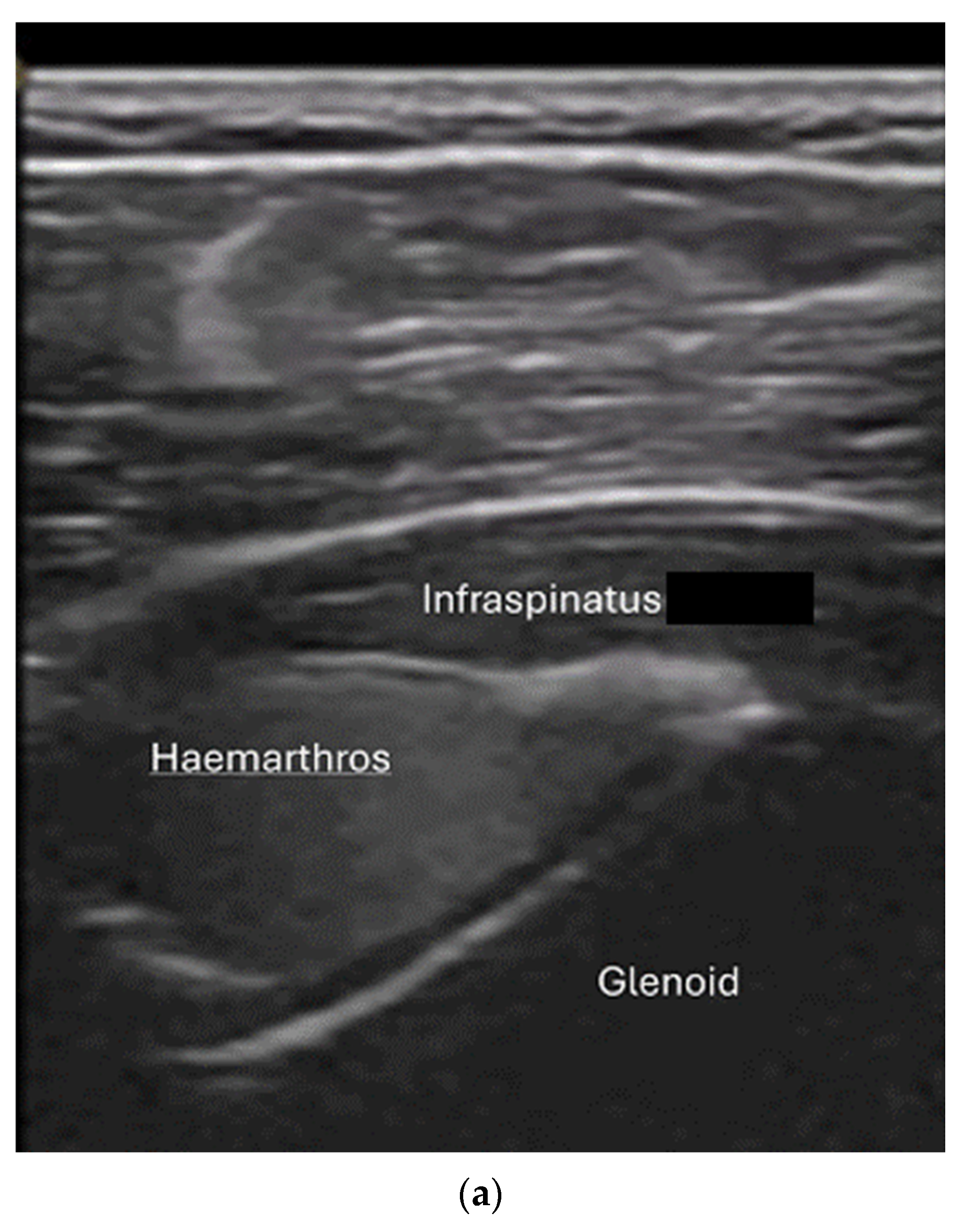 Diagnostics 15 01827 g013a Diagnostics 15 01827 g013a