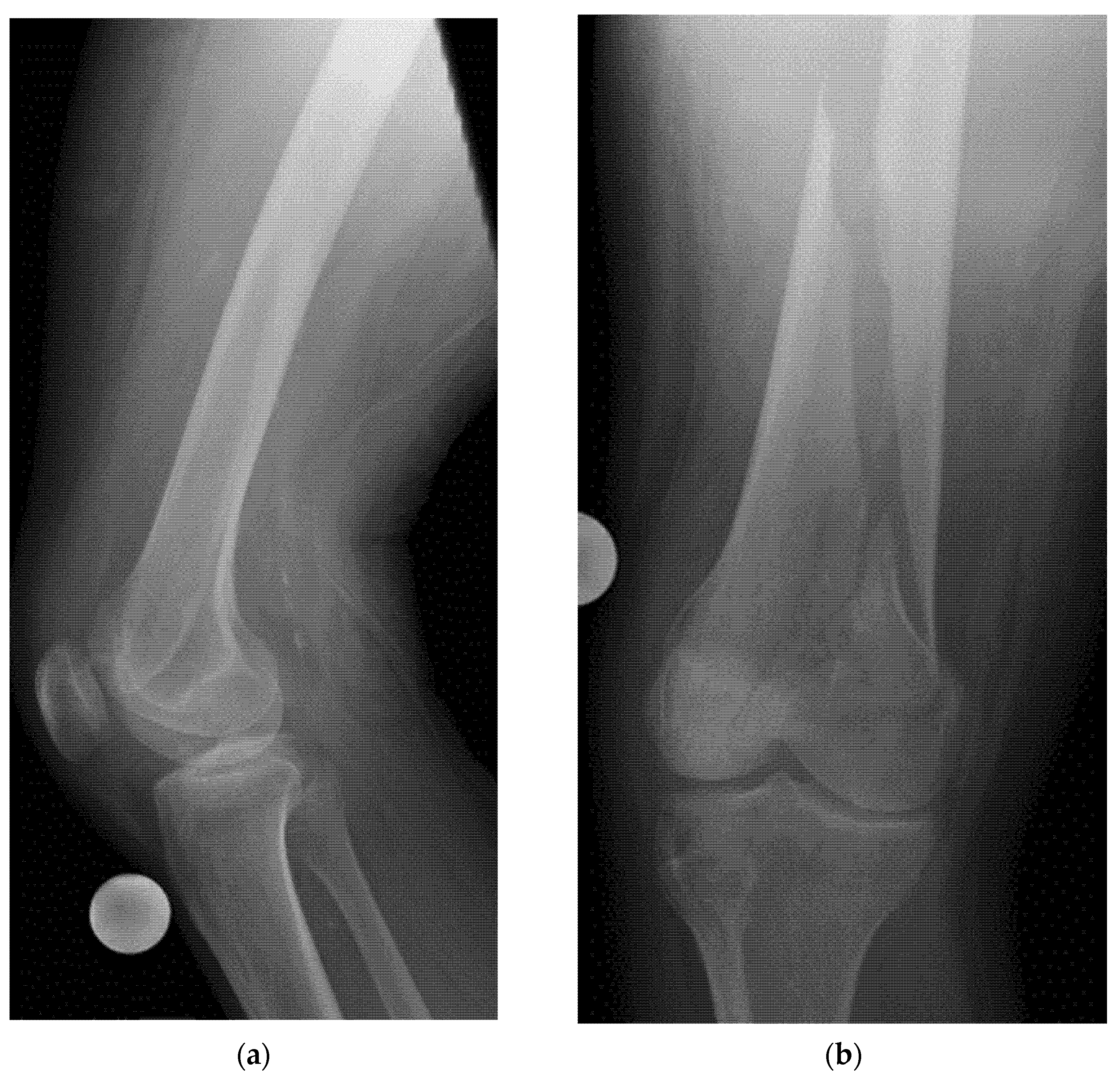 Diagnostics 15 01827 g016 Diagnostics 15 01827 g016