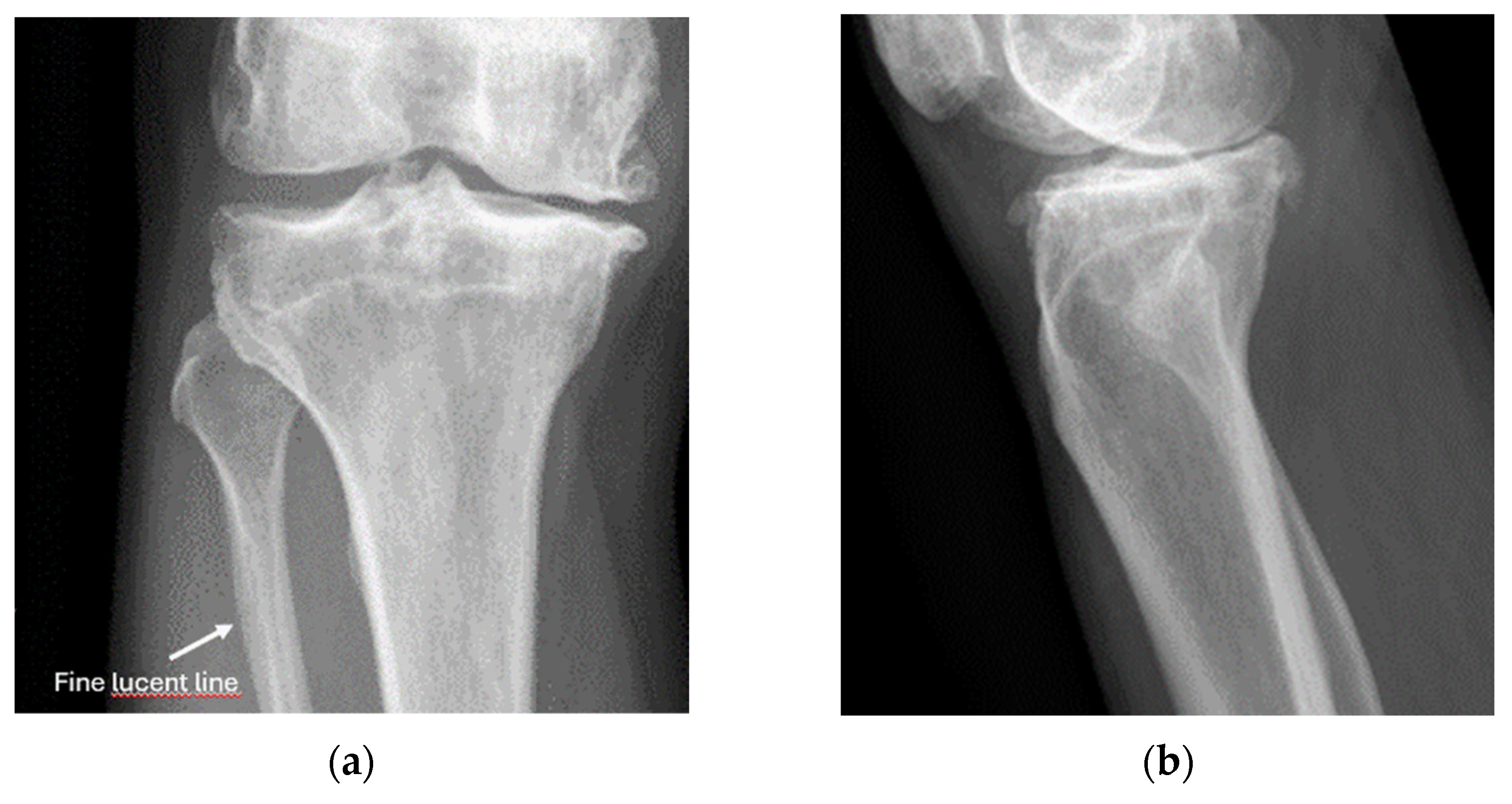 Diagnostics 15 01827 g018 Diagnostics 15 01827 g018
