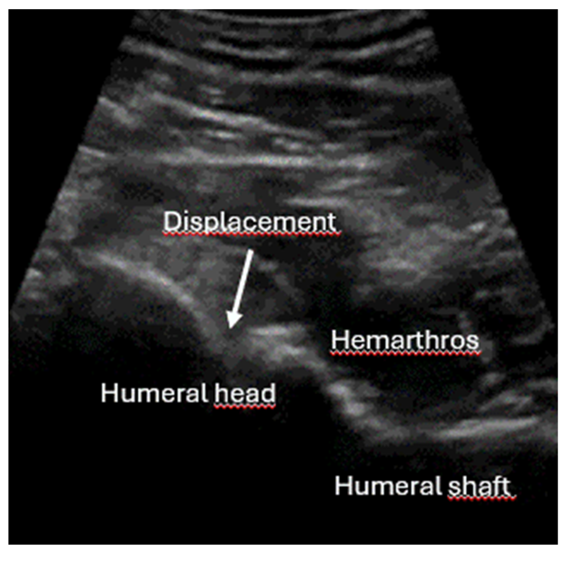 Diagnostics 15 01827 g019 Diagnostics 15 01827 g019