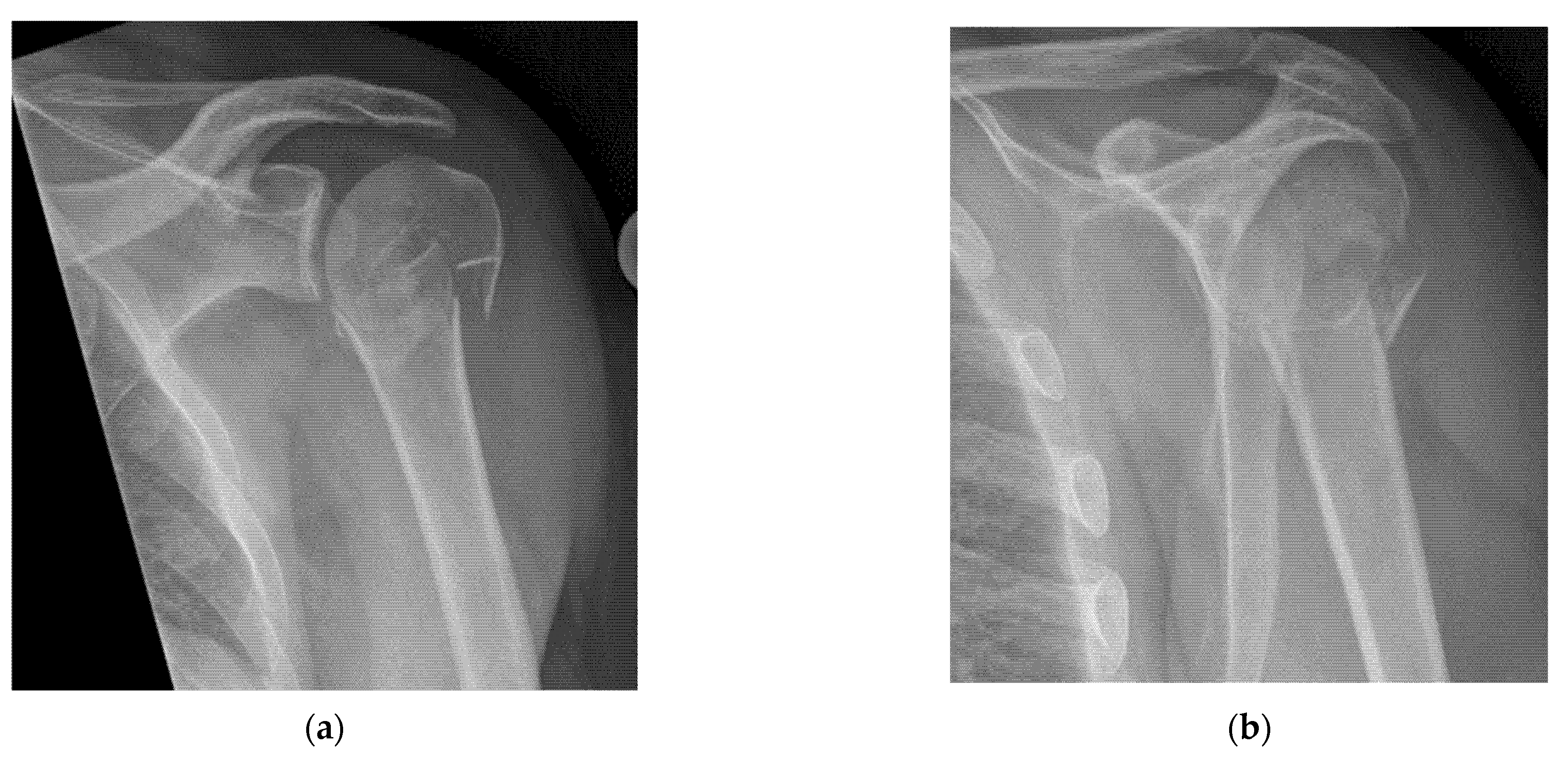 Diagnostics 15 01827 g020 Diagnostics 15 01827 g020