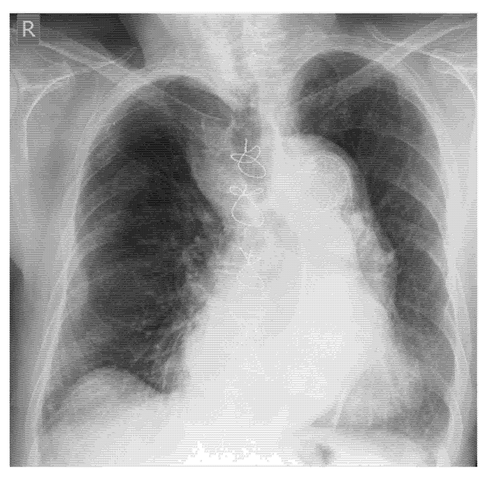 Diagnostics 15 01827 g021 Diagnostics 15 01827 g021