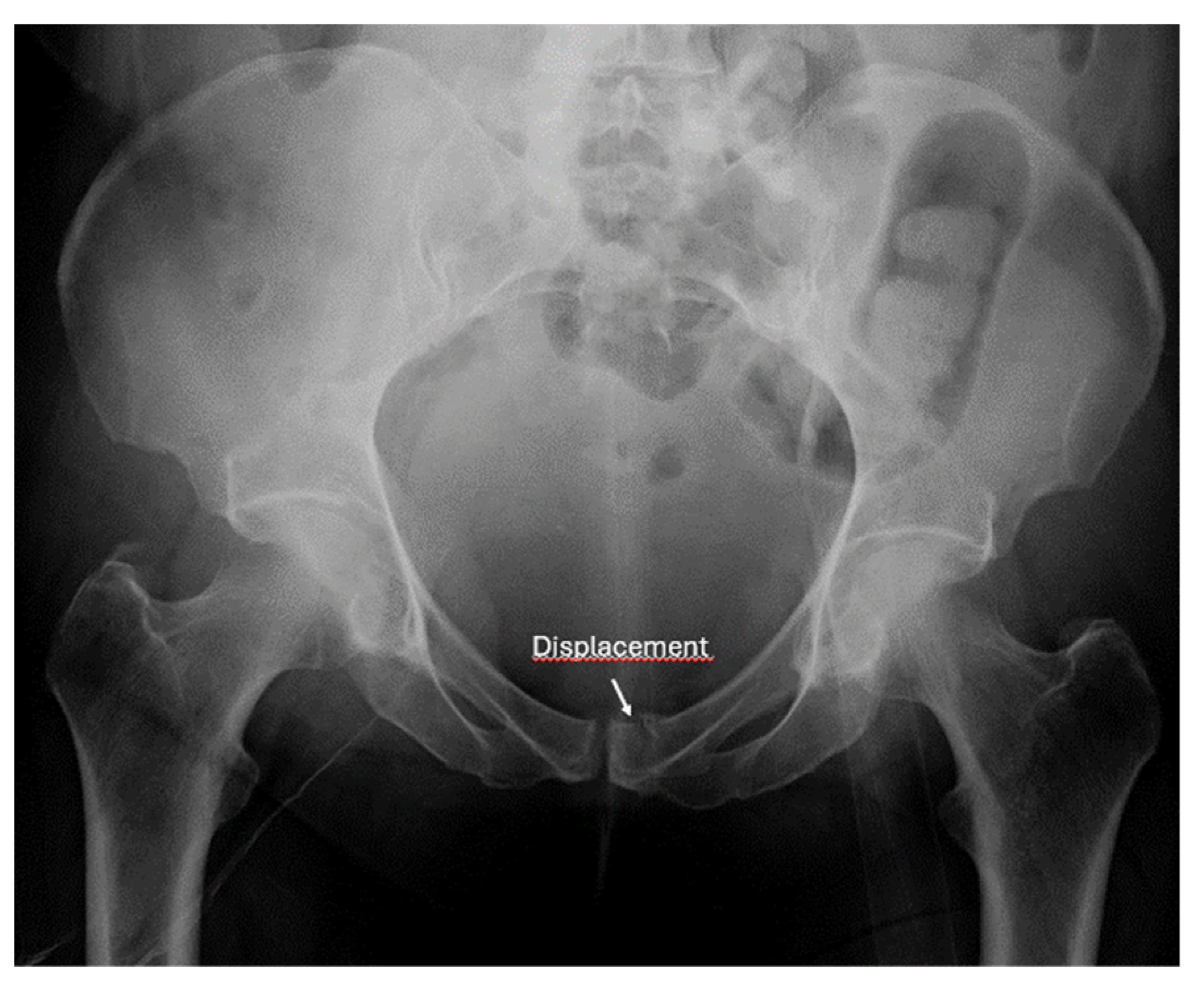 Diagnostics 15 01827 g023 Diagnostics 15 01827 g023