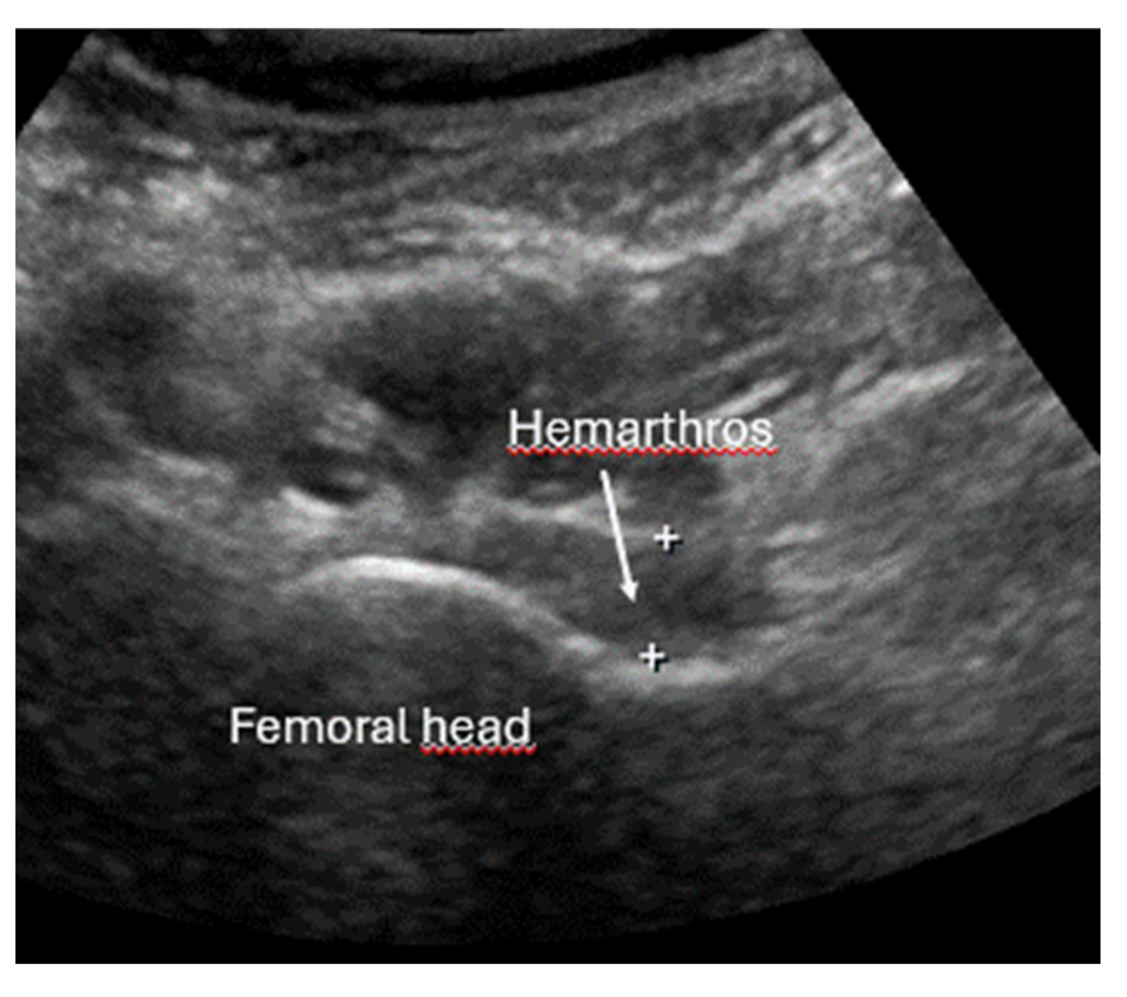 Diagnostics 15 01827 g024 Diagnostics 15 01827 g024