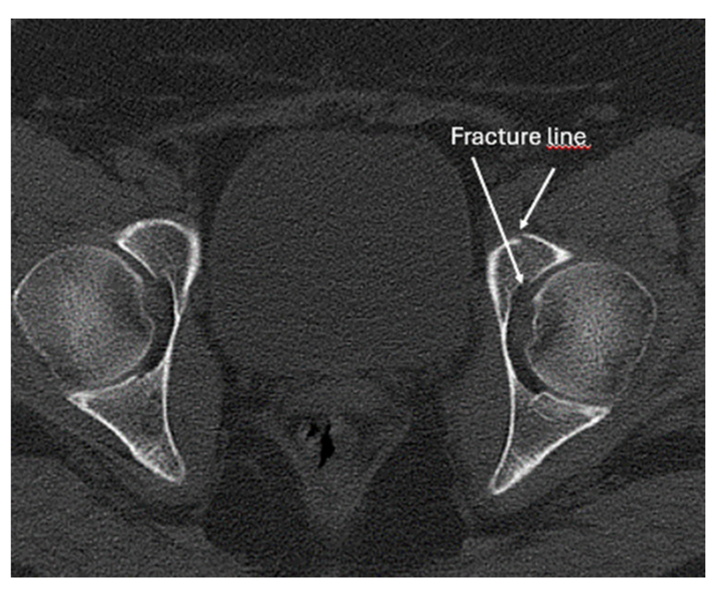 Diagnostics 15 01827 g025 Diagnostics 15 01827 g025