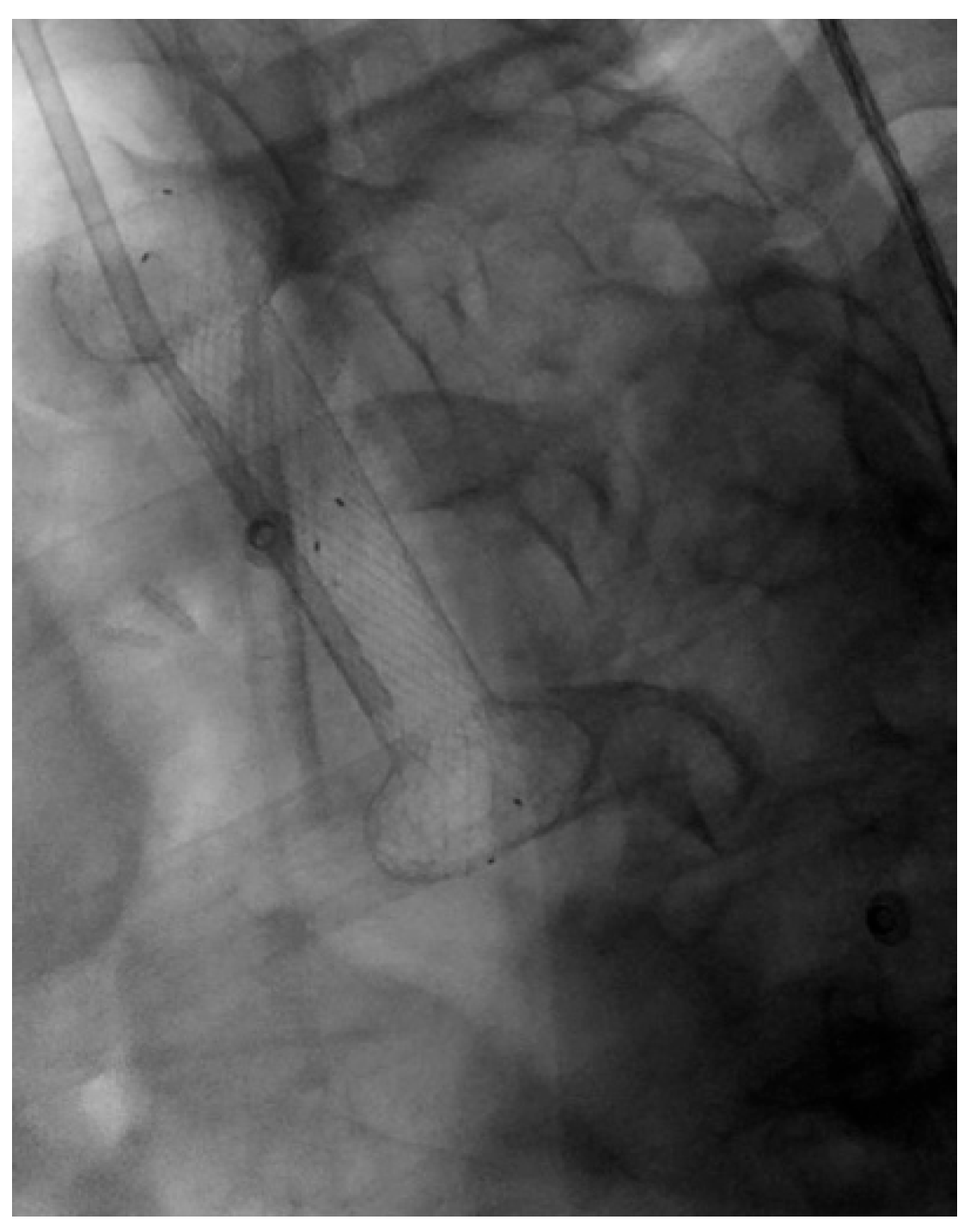 Diagnostics 15 02344 g003 Diagnostics 15 02344 g003