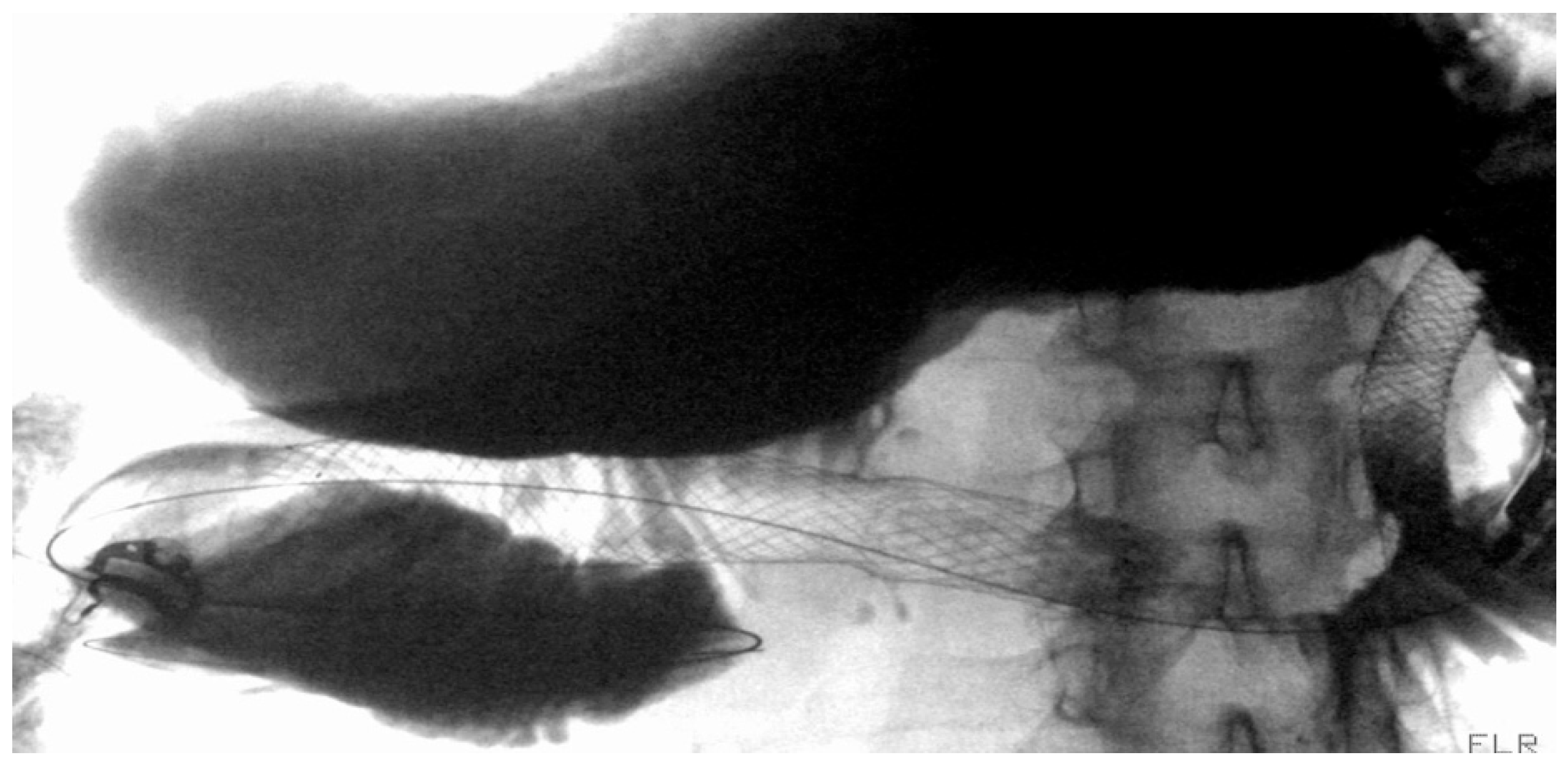 Diagnostics 15 02344 g008 Diagnostics 15 02344 g008