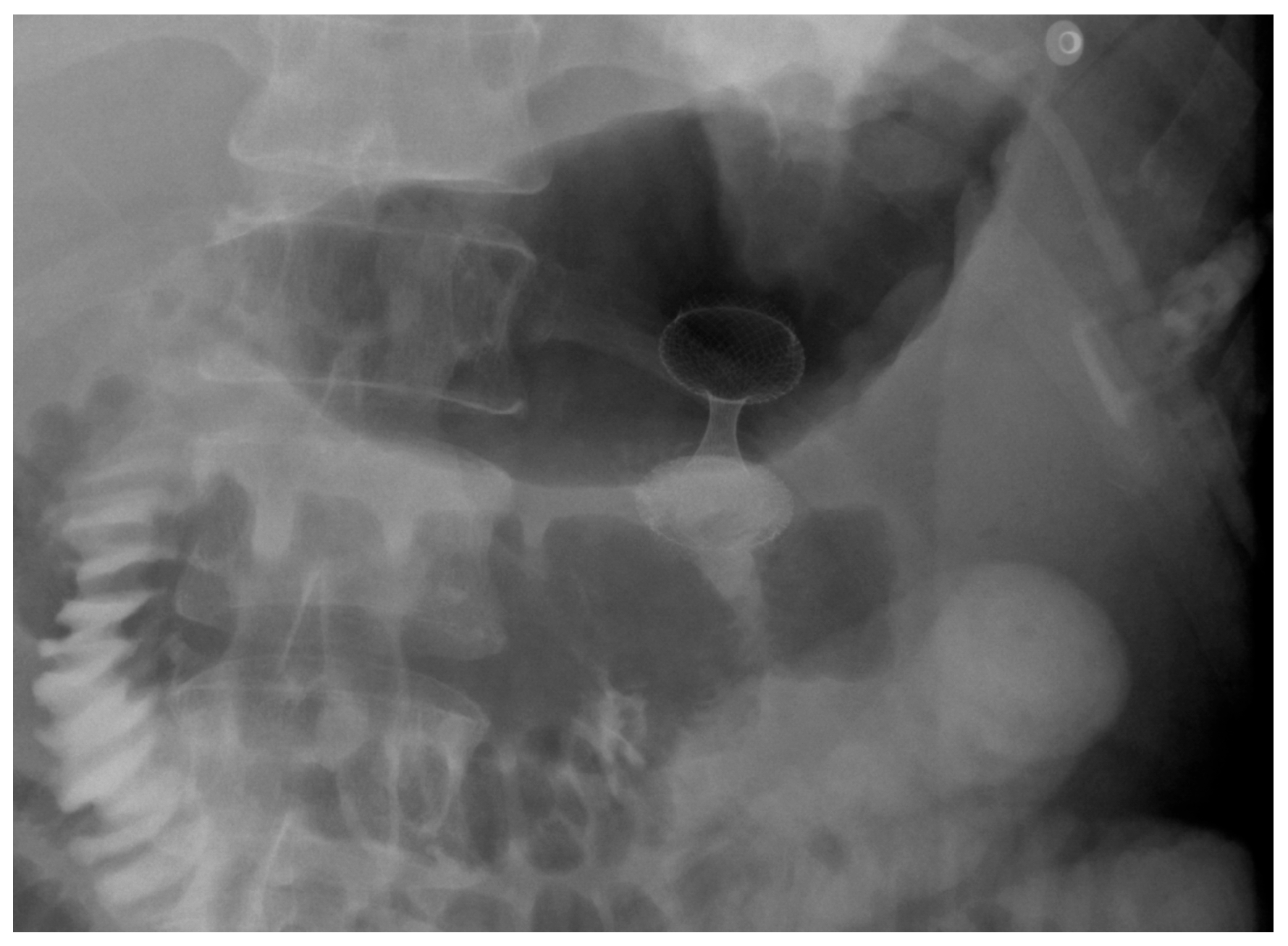 Diagnostics 15 02344 g009 Diagnostics 15 02344 g009