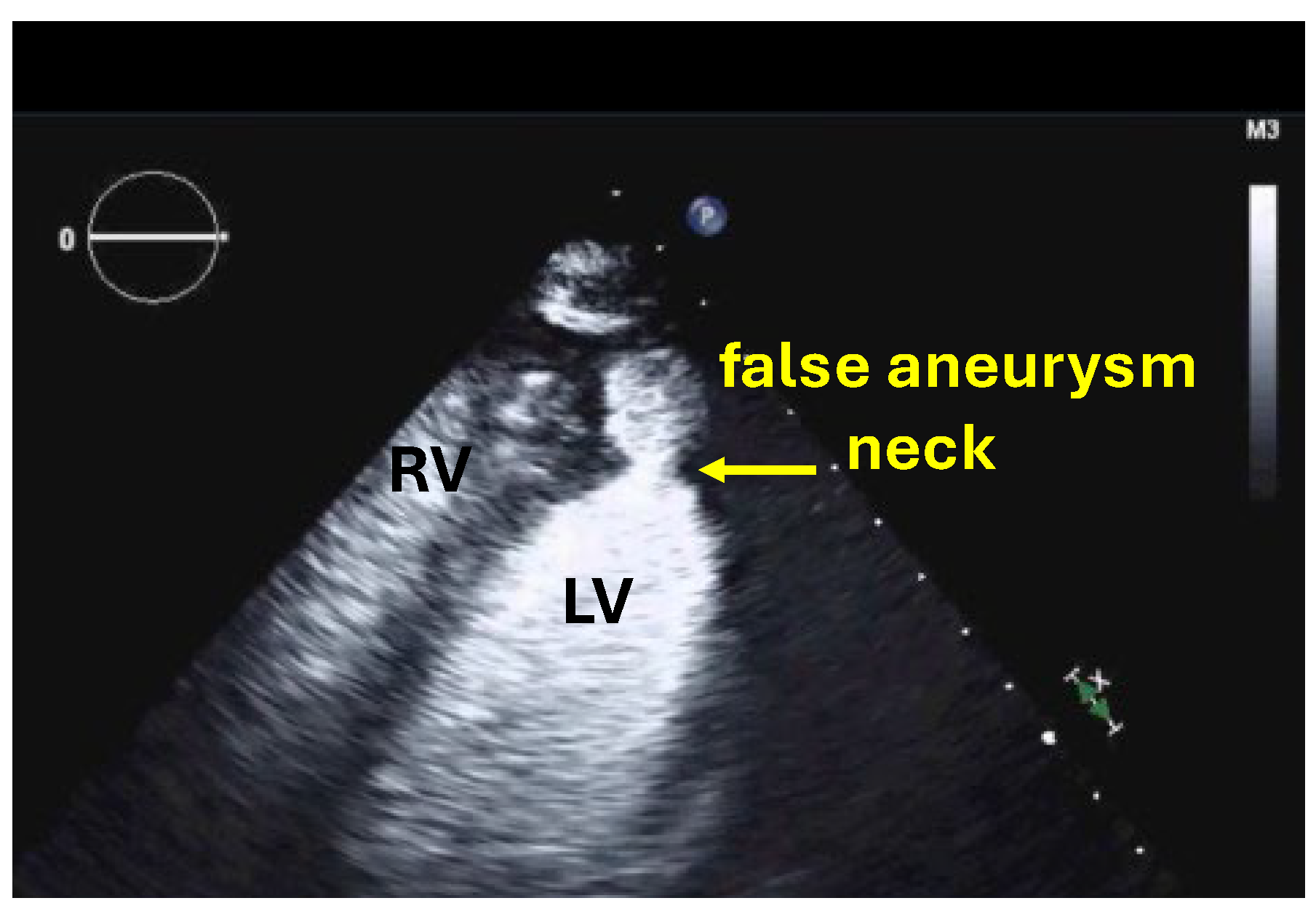 Diagnostics 15 02371 g002 Diagnostics 15 02371 g002