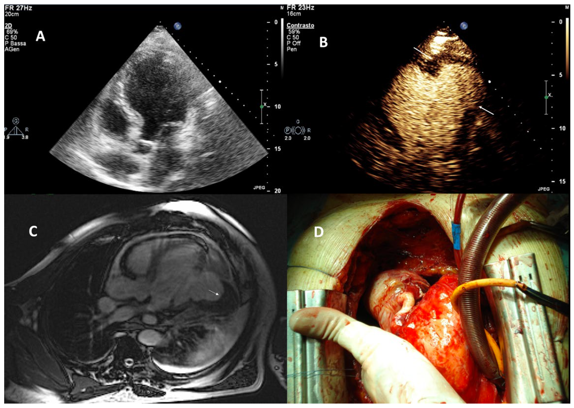 Diagnostics 15 02371 g003 Diagnostics 15 02371 g003