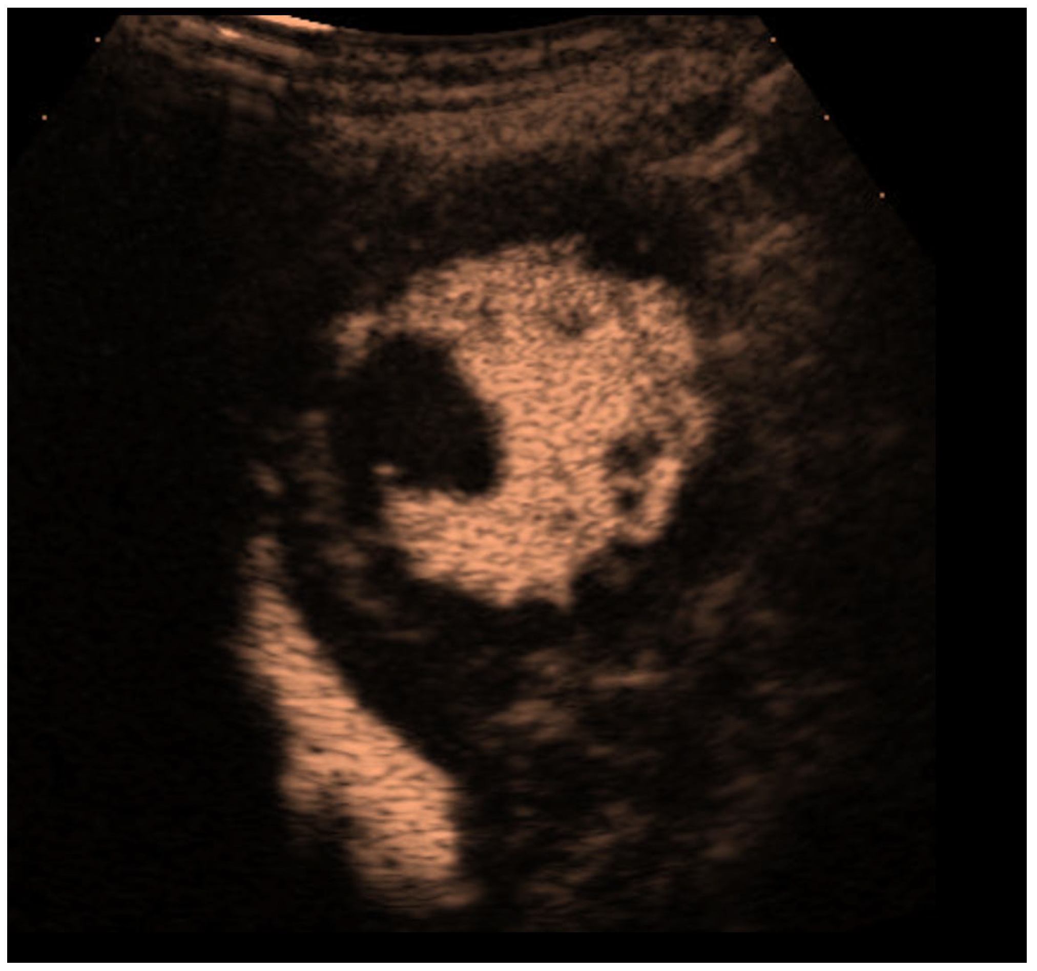 Diagnostics 15 02371 g006 Diagnostics 15 02371 g006