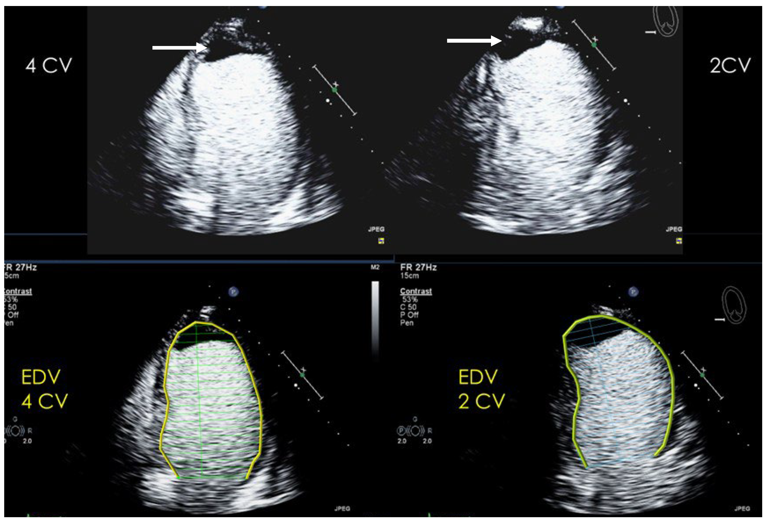 Diagnostics 15 02371 g007 Diagnostics 15 02371 g007