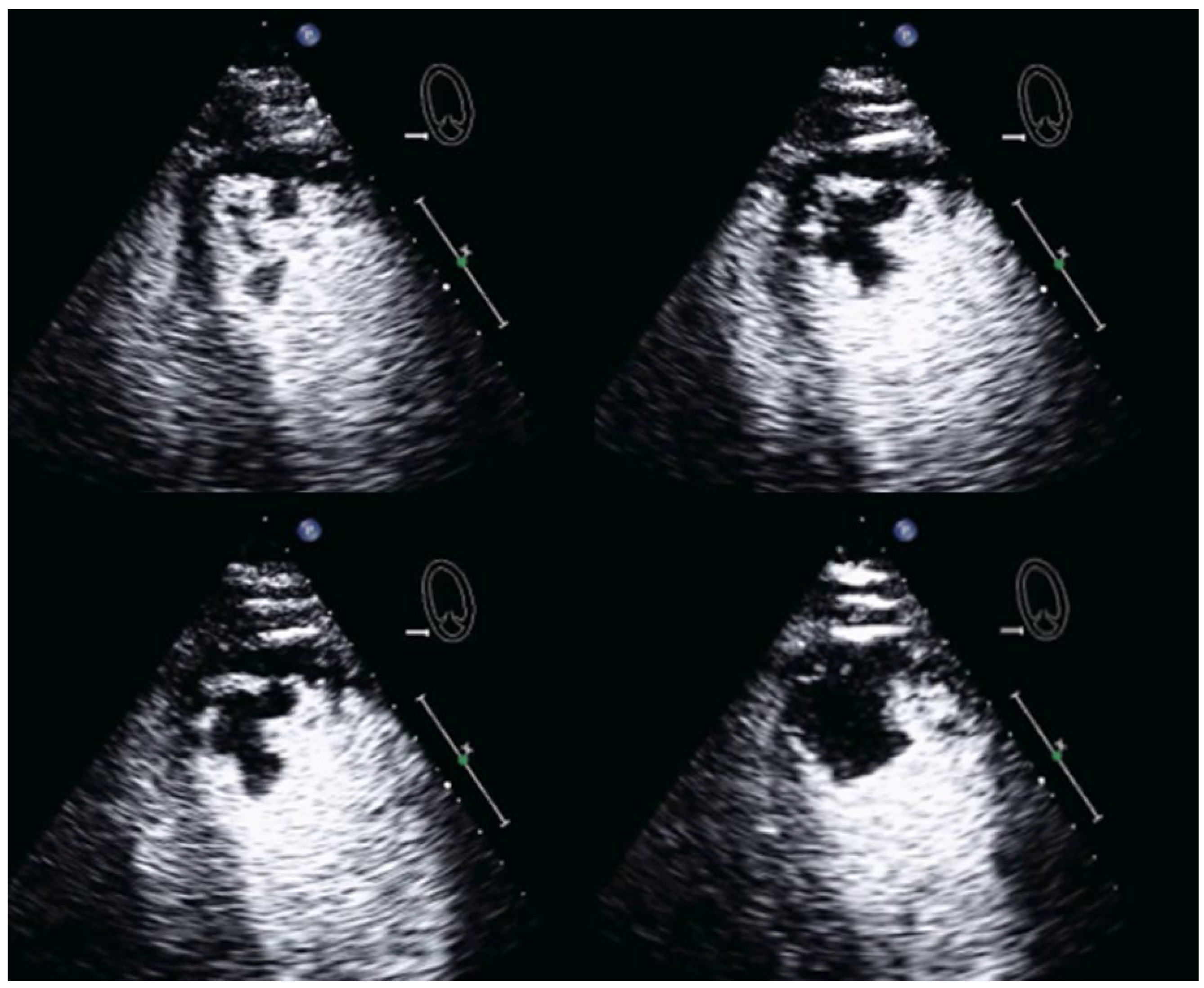 Diagnostics 15 02371 g009 Diagnostics 15 02371 g009