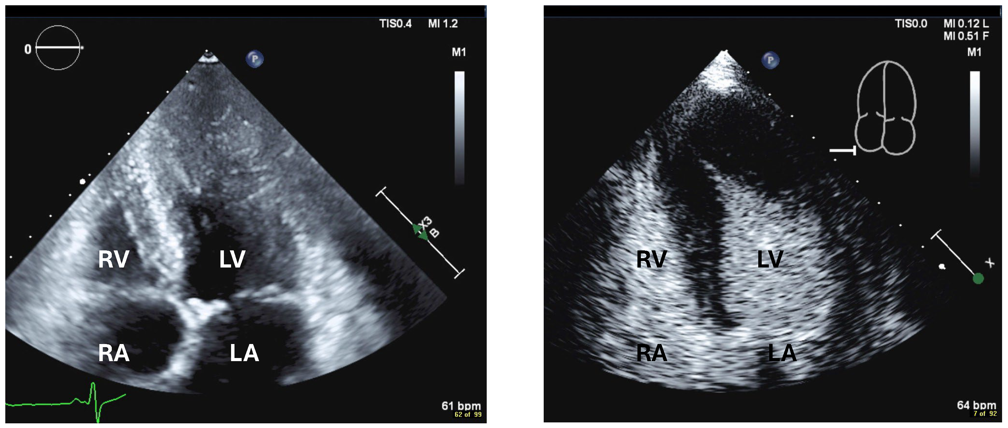 Diagnostics 15 02371 g010 Diagnostics 15 02371 g010