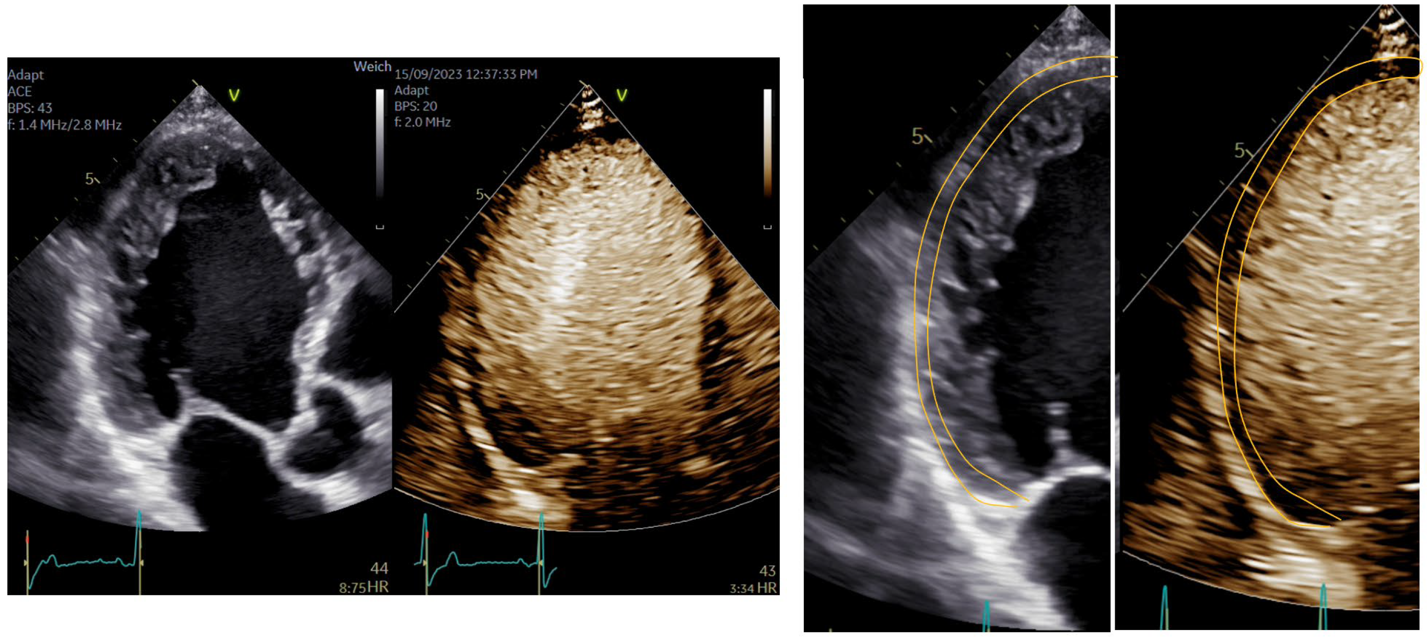 Diagnostics 15 02371 g011 Diagnostics 15 02371 g011