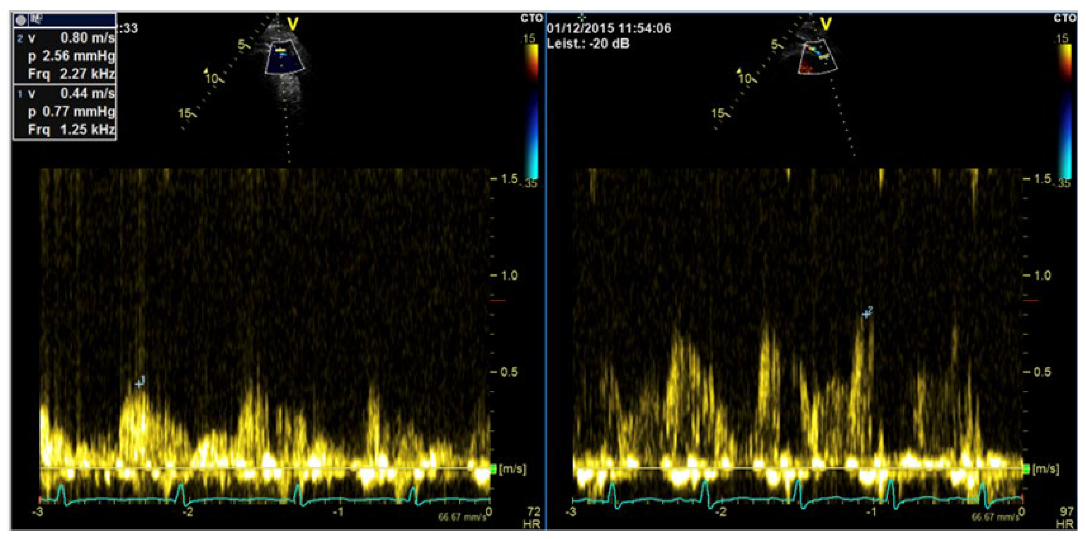 Diagnostics 15 02371 g012 Diagnostics 15 02371 g012