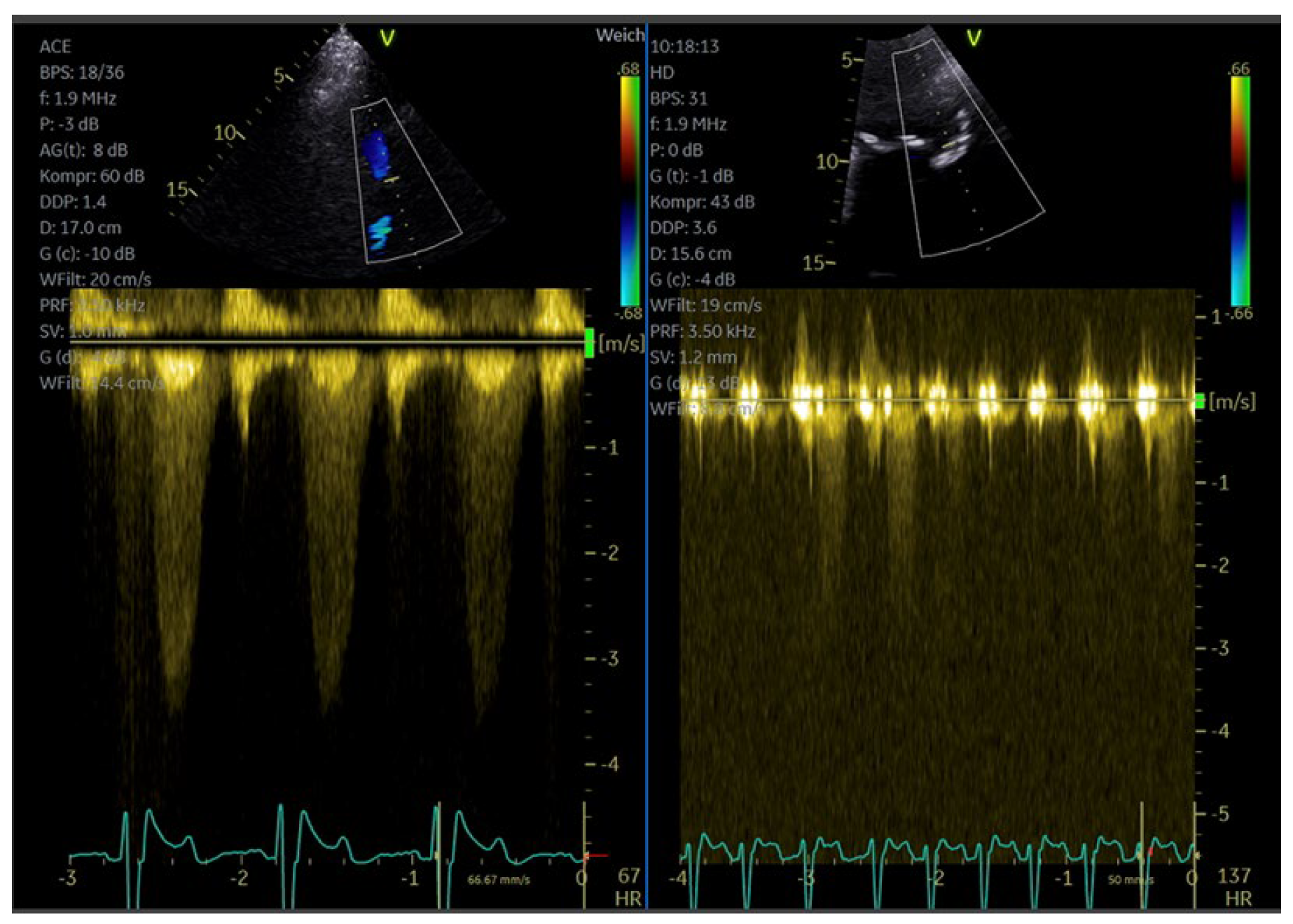 Diagnostics 15 02371 g013 Diagnostics 15 02371 g013