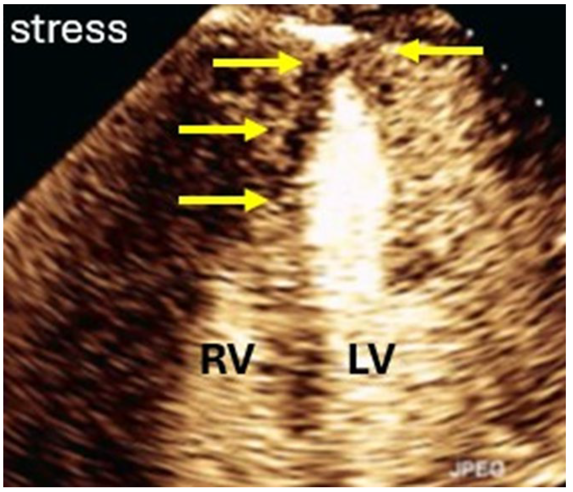 Diagnostics 15 02371 g015 Diagnostics 15 02371 g015