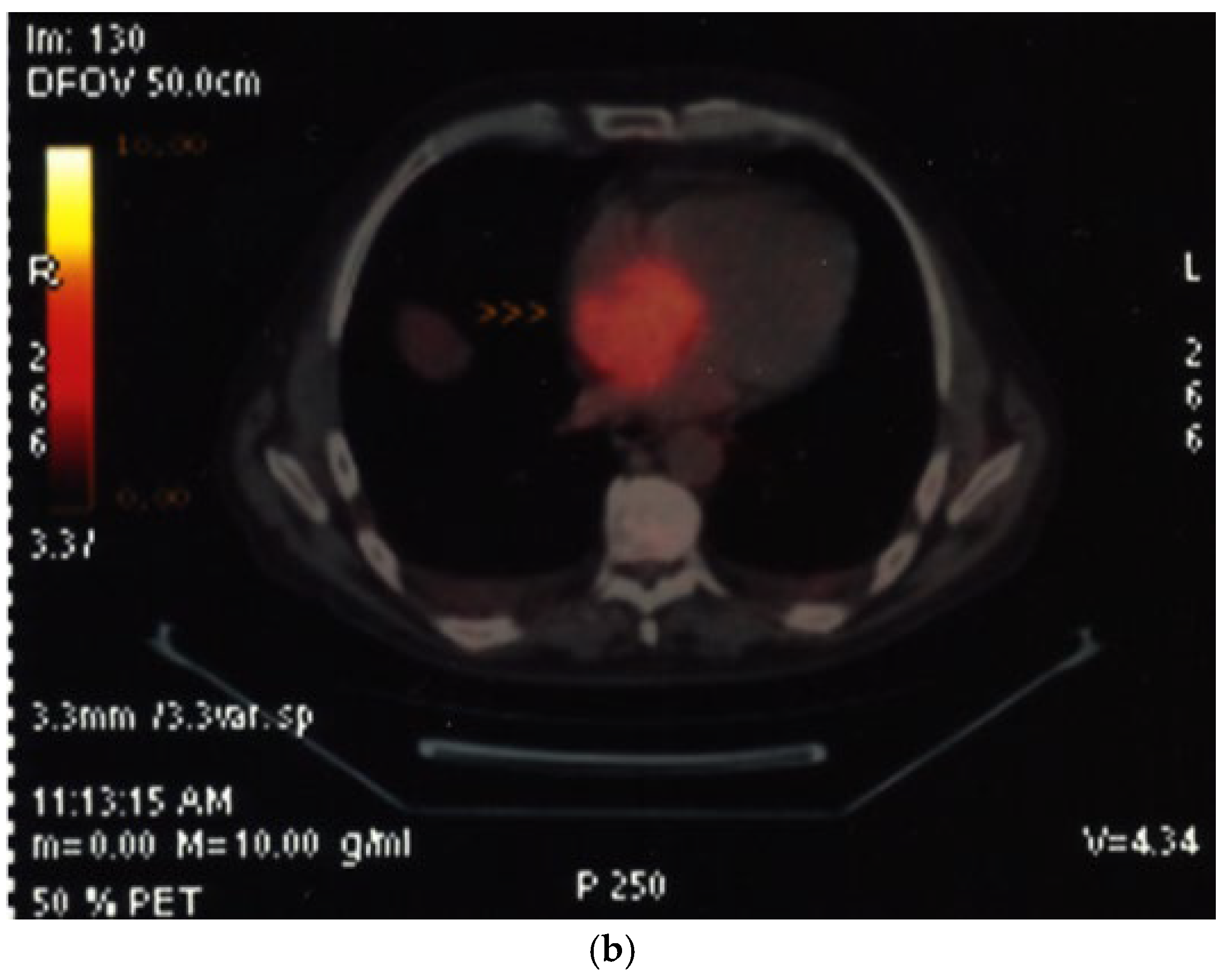 Diagnostics 15 02371 g016b Diagnostics 15 02371 g016b