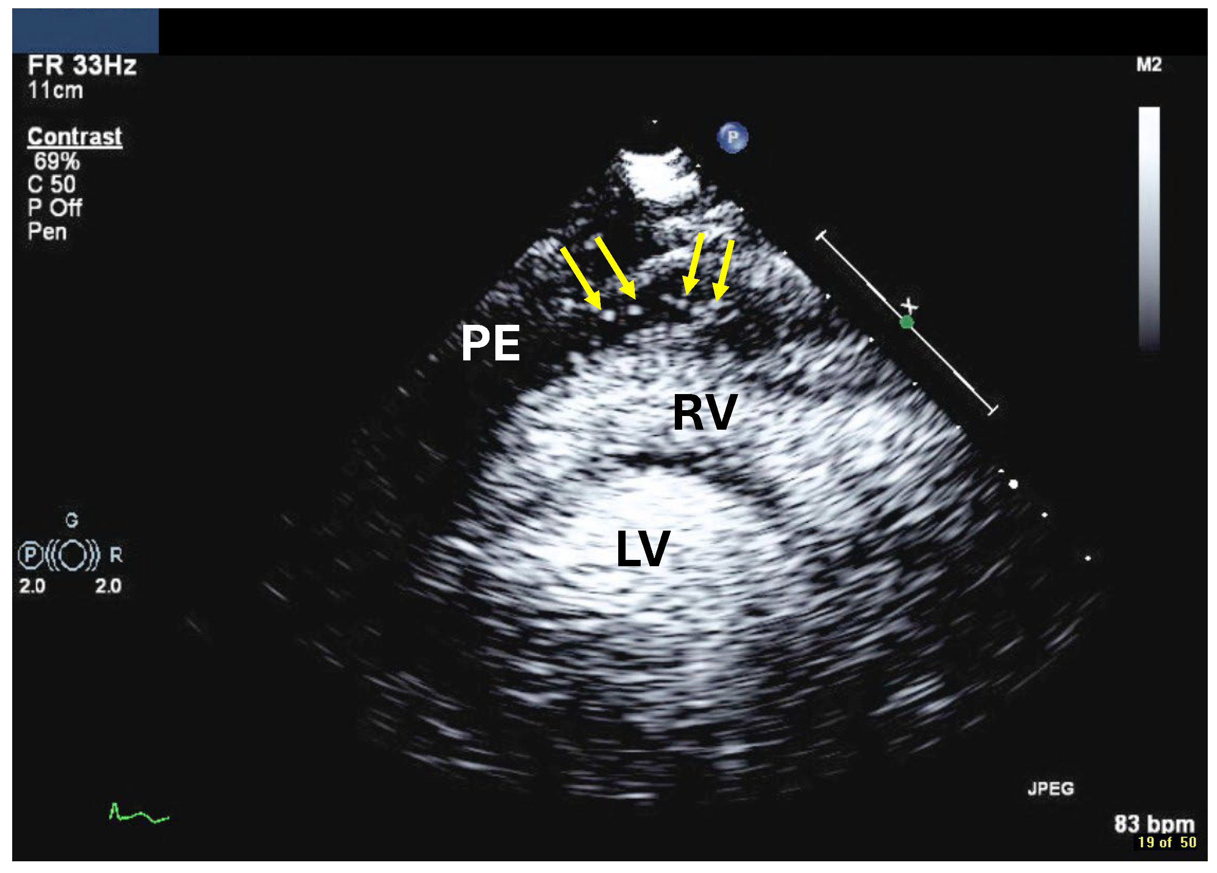 Diagnostics 15 02371 g017 Diagnostics 15 02371 g017