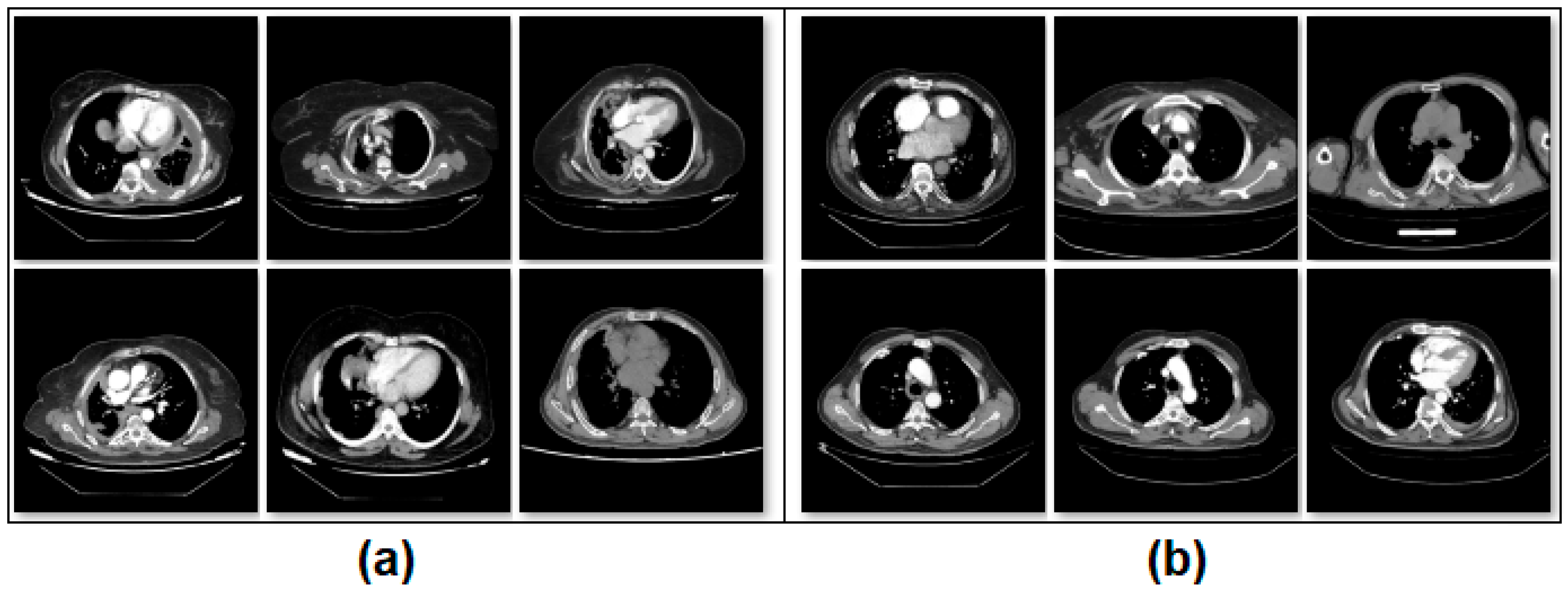 Diagnostics 15 02381 g001 Diagnostics 15 02381 g001