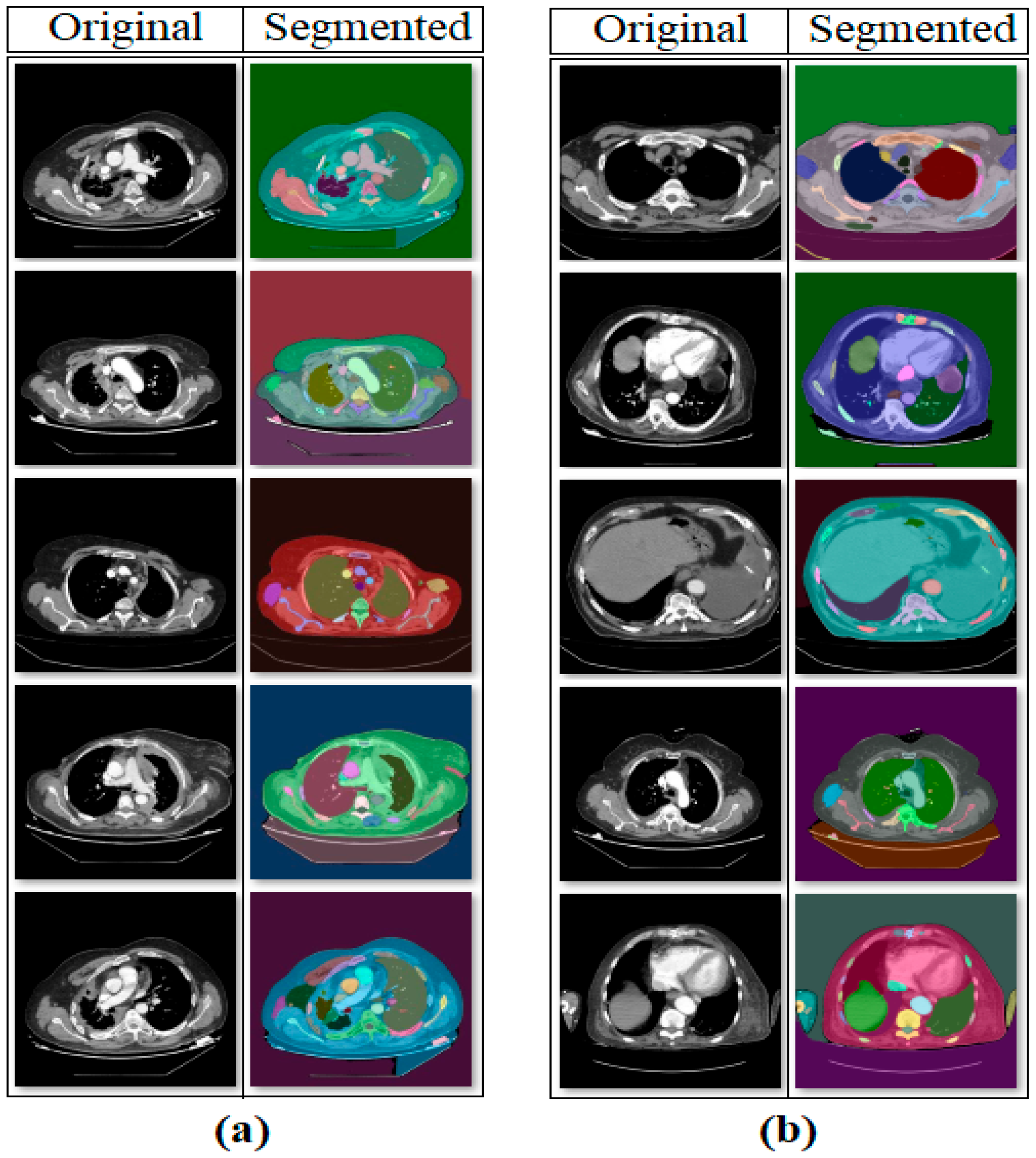 Diagnostics 15 02381 g005 Diagnostics 15 02381 g005