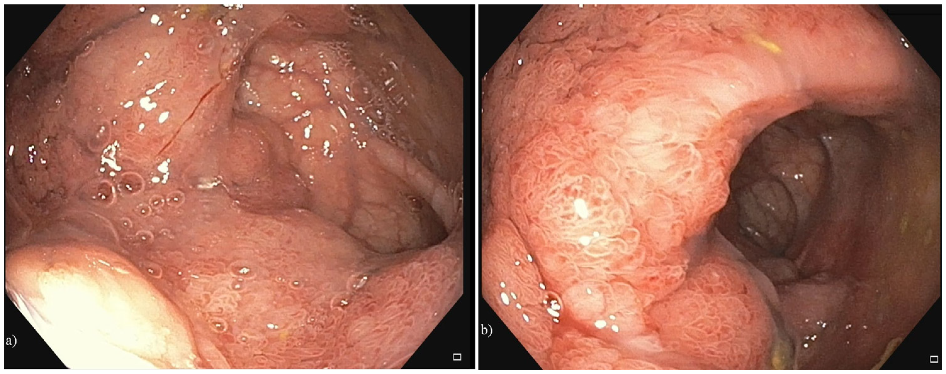 Diagnostics 15 02459 g001 Diagnostics 15 02459 g001