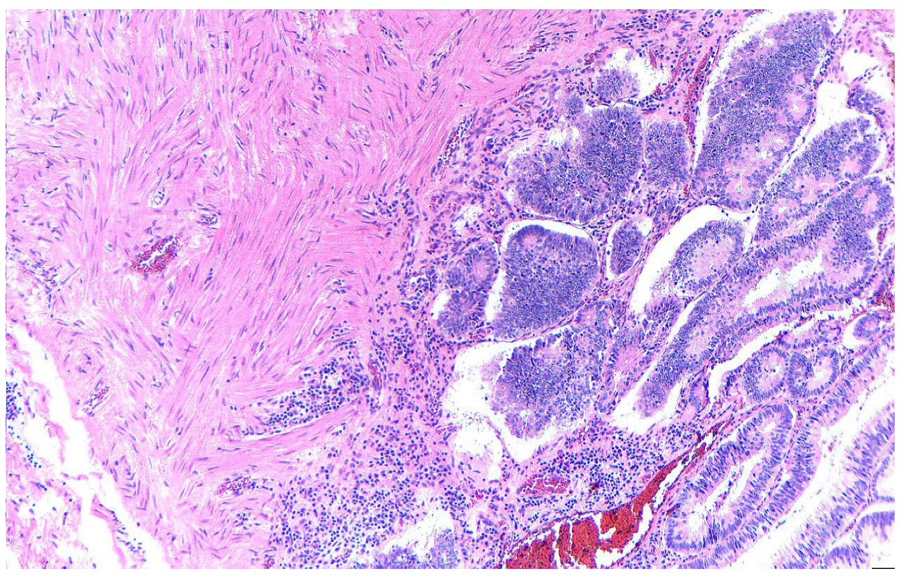 Diagnostics 15 02459 g005 Diagnostics 15 02459 g005