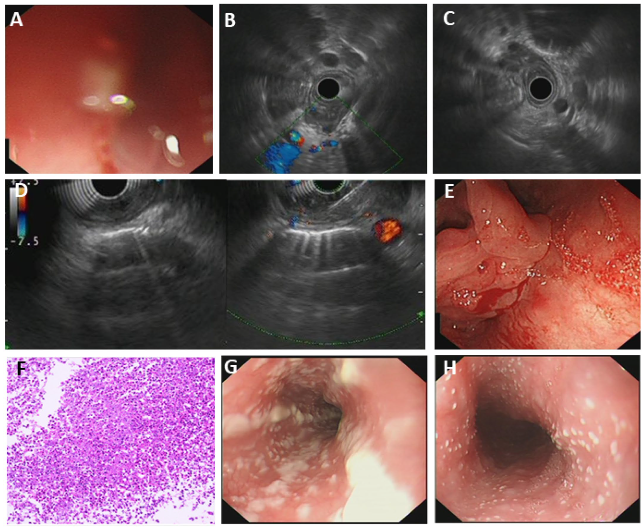 Diagnostics 15 02470 g002 Diagnostics 15 02470 g002