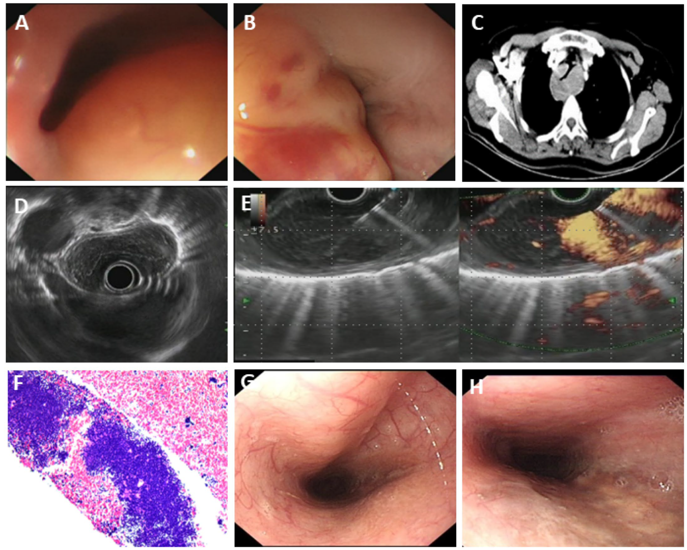 Diagnostics 15 02470 g005 Diagnostics 15 02470 g005