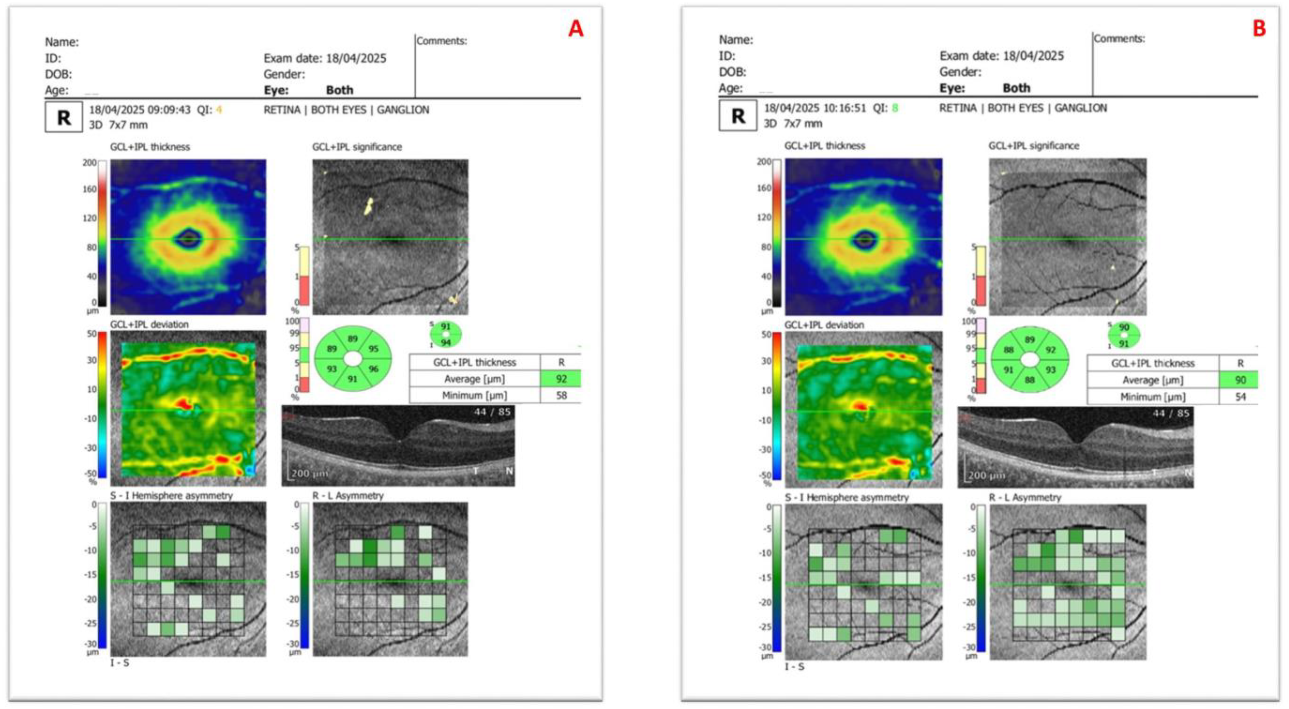 Diagnostics 15 02541 g002 Diagnostics 15 02541 g002