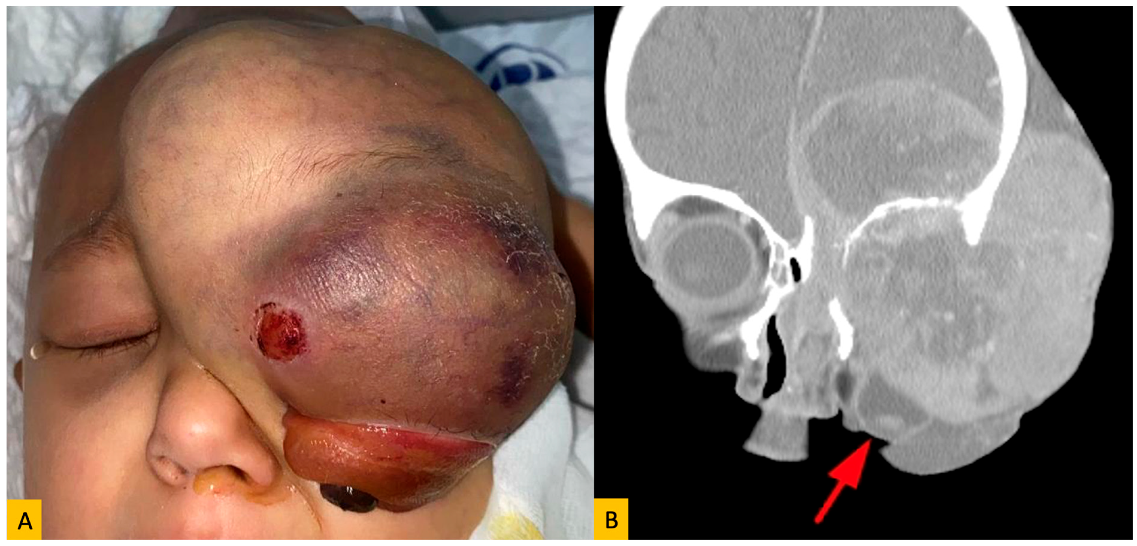 Diagnostics 15 02542 g003 Diagnostics 15 02542 g003