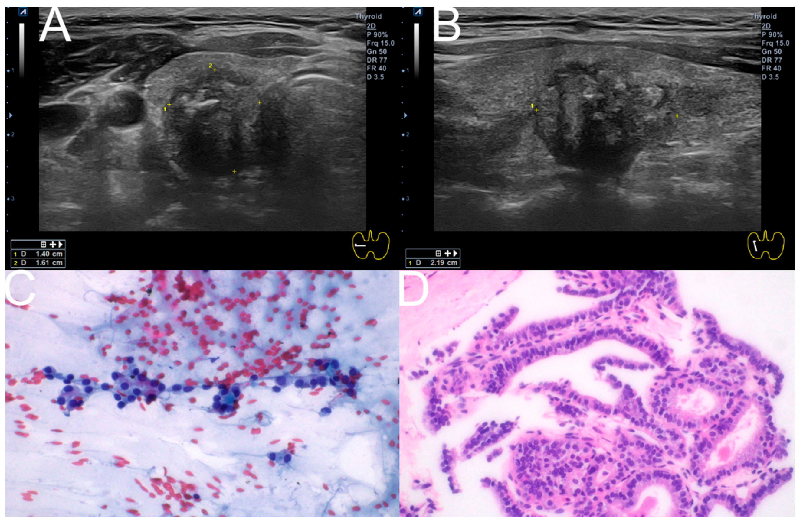 Diagnostics 15 02566 g006 Diagnostics 15 02566 g006