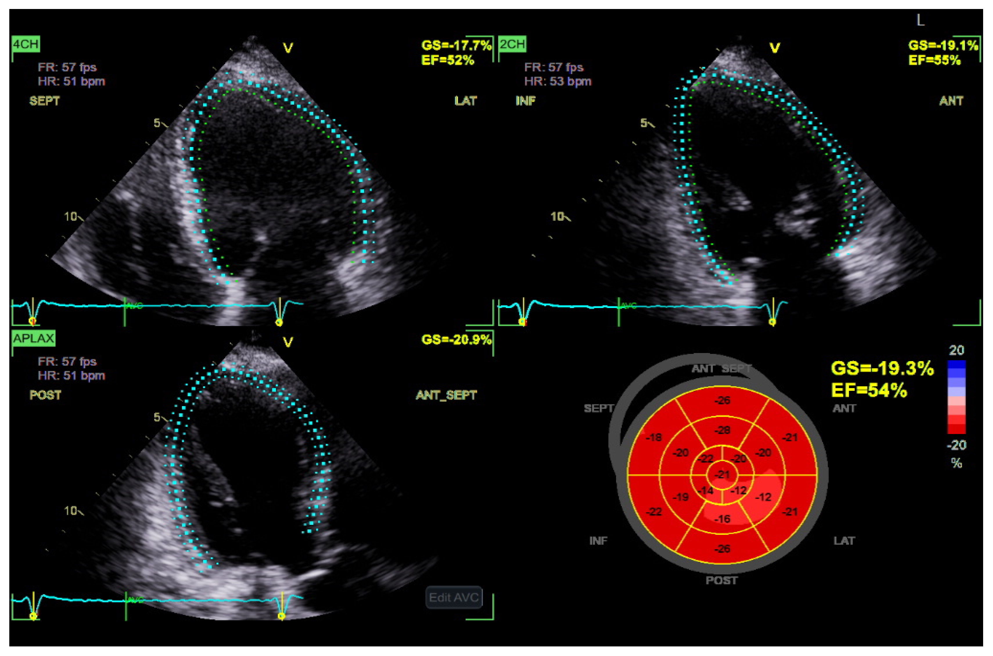 Diagnostics 15 02587 g003 Diagnostics 15 02587 g003