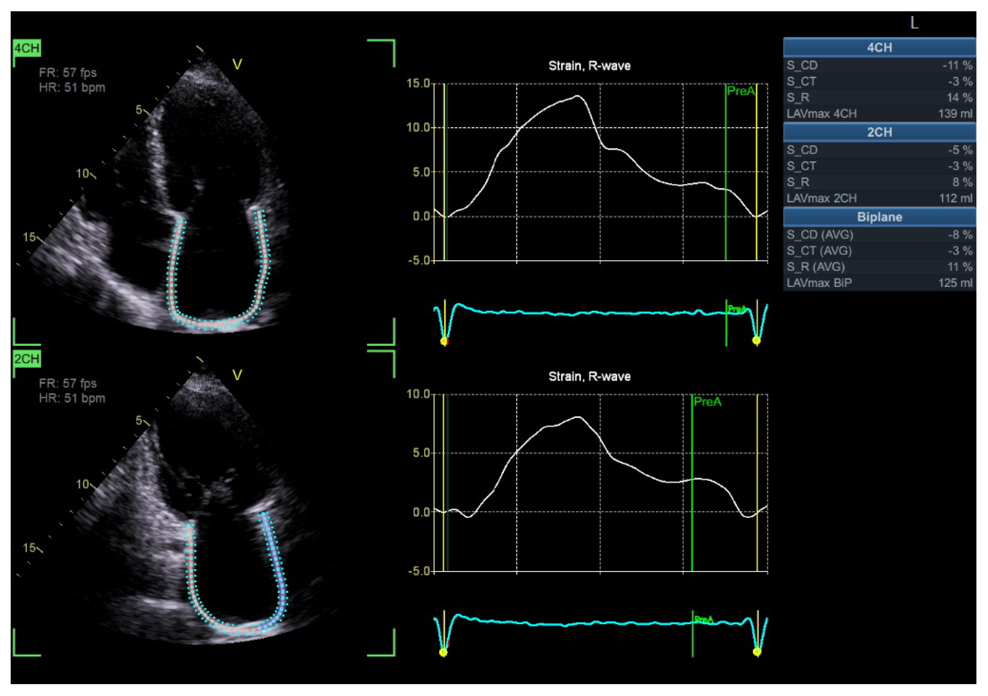 Diagnostics 15 02587 g005 Diagnostics 15 02587 g005