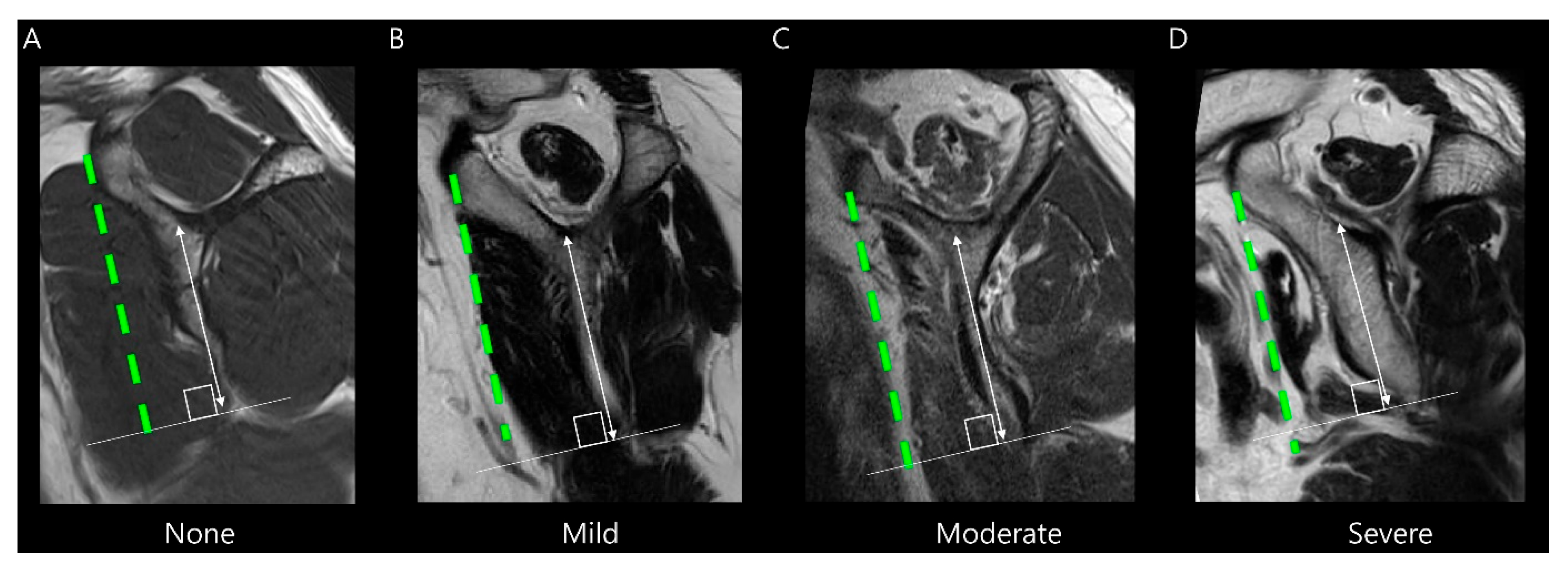 Diagnostics 15 02670 g004 Diagnostics 15 02670 g004