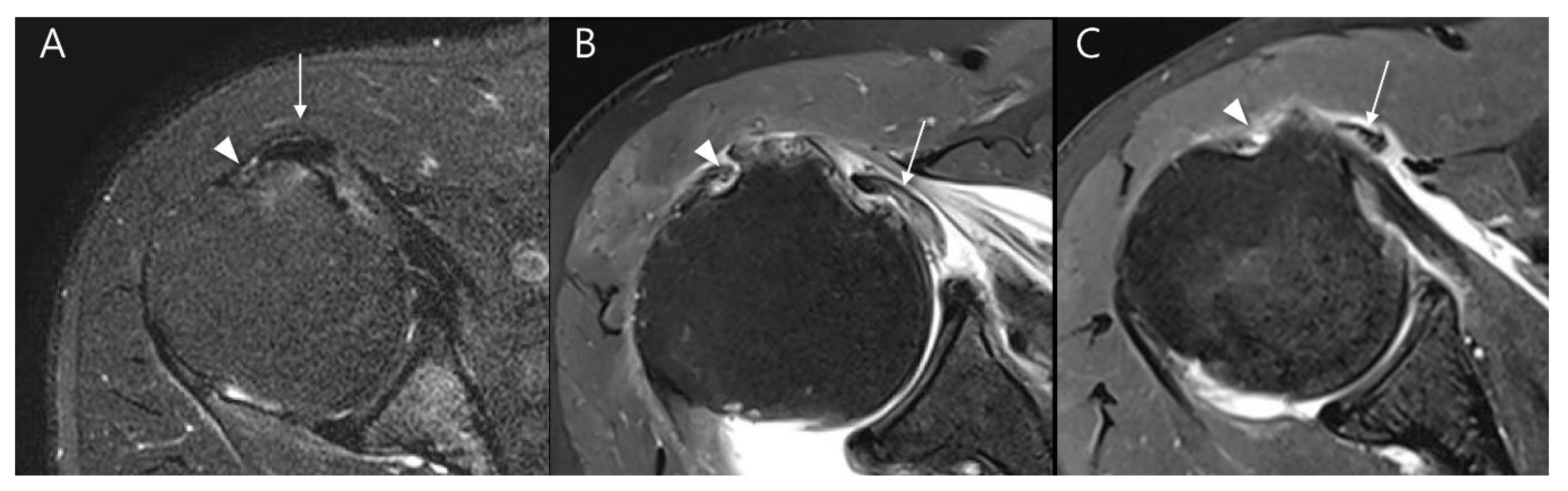 Diagnostics 15 02670 g007 Diagnostics 15 02670 g007