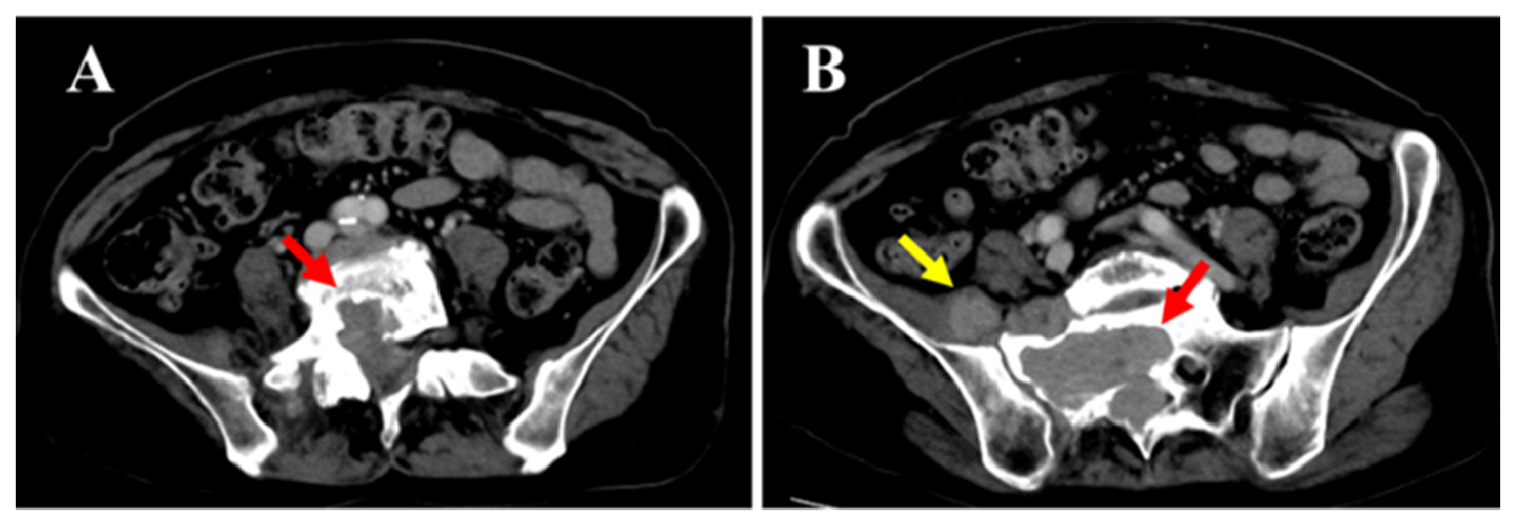 Diagnostics 15 02697 g003 Diagnostics 15 02697 g003
