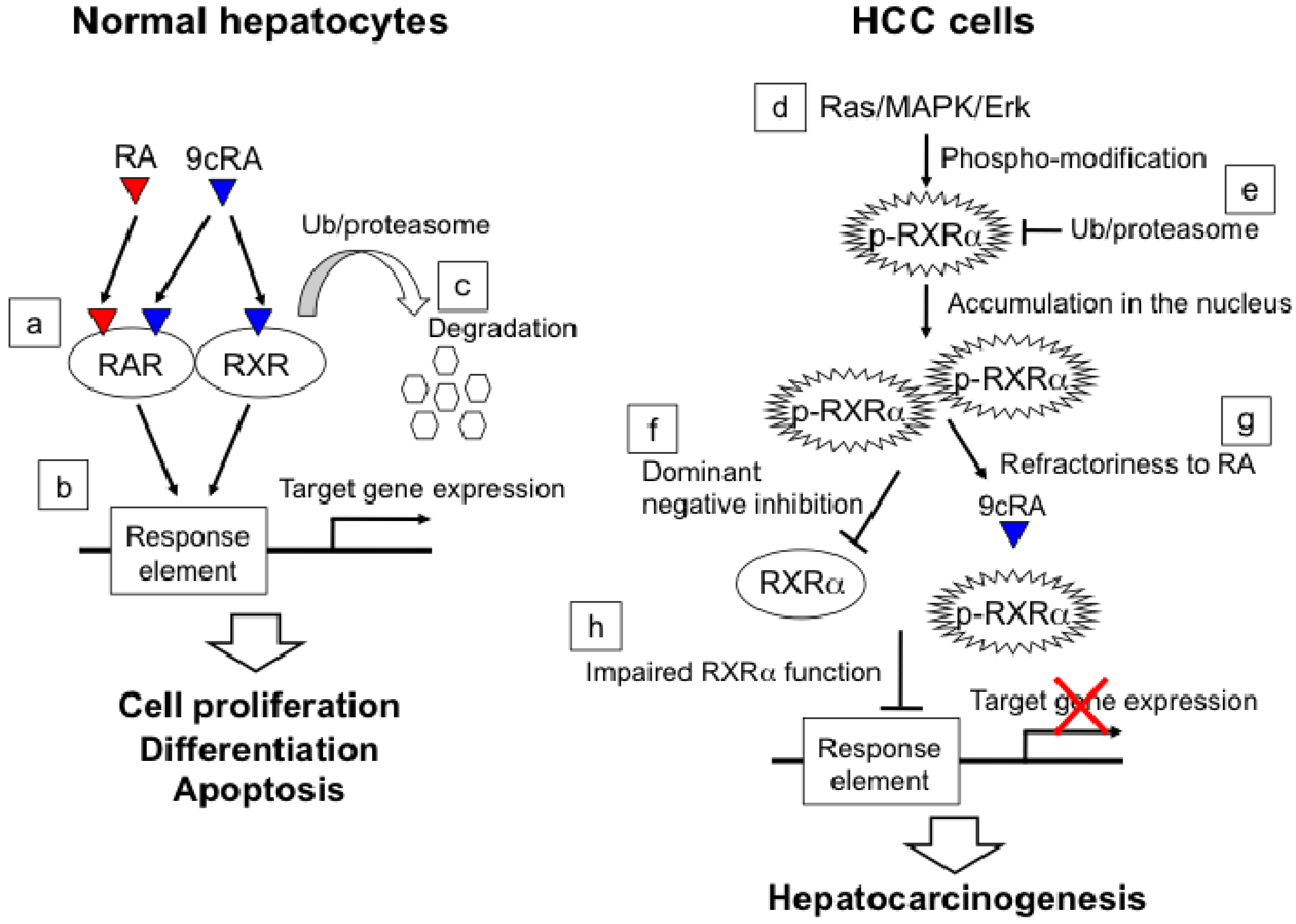 Diseases | Free Full-Text | A Role for Acyclic Retinoid in the  Chemoprevention of Hepatocellular Carcinoma: Therapeutic Strategy Targeting  Phosphorylated Retinoid X Receptor-α | HTML