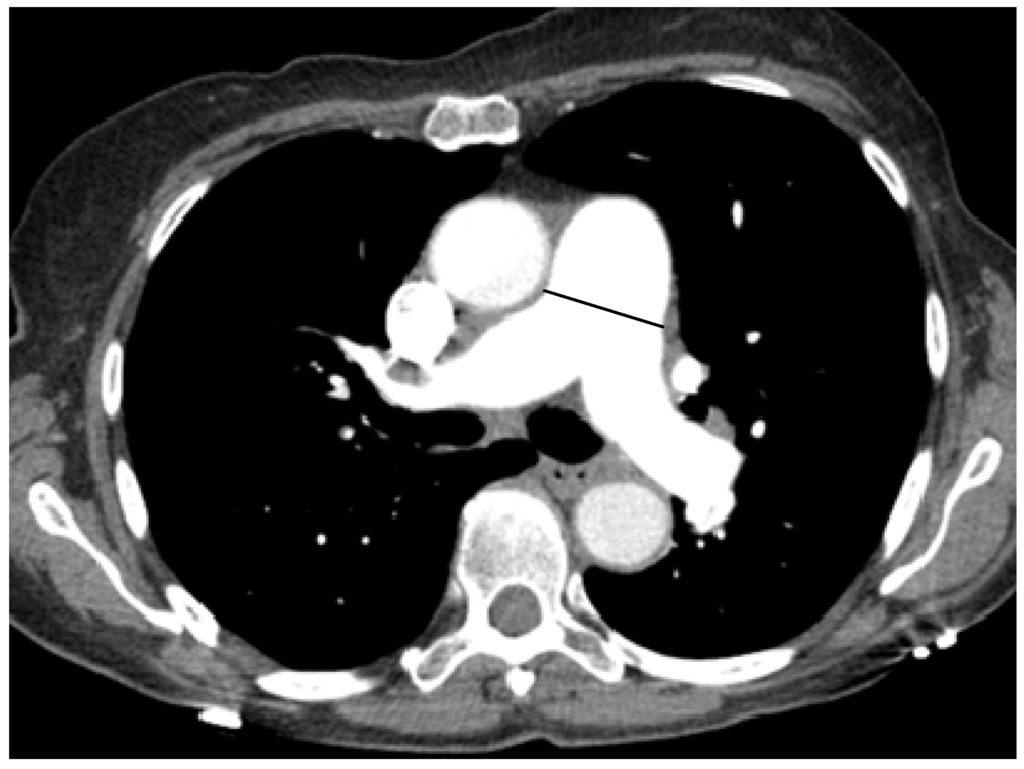 Diseases  Free Full-Text  The Significance of Pulmonary 