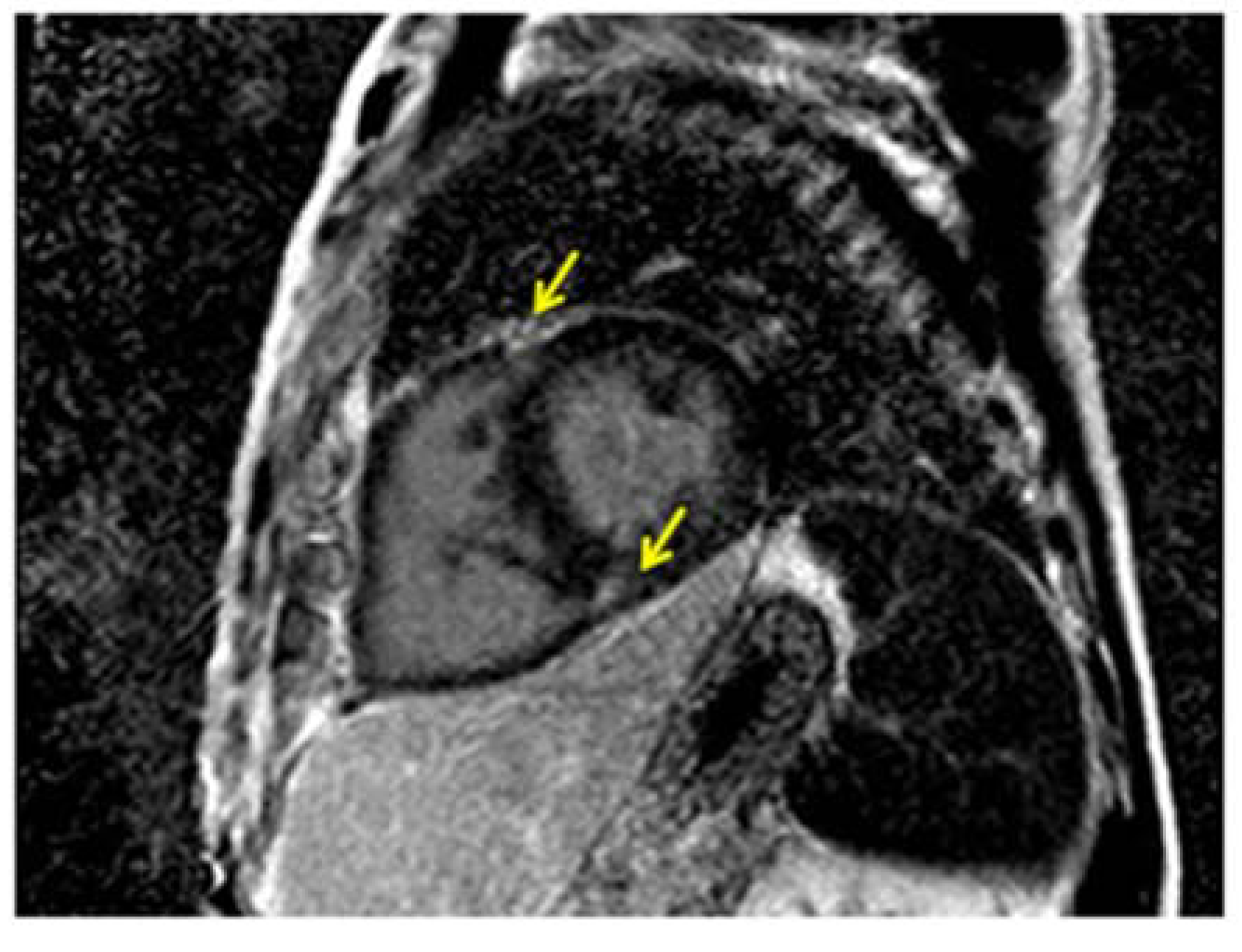 Diseases 02 00274 g007